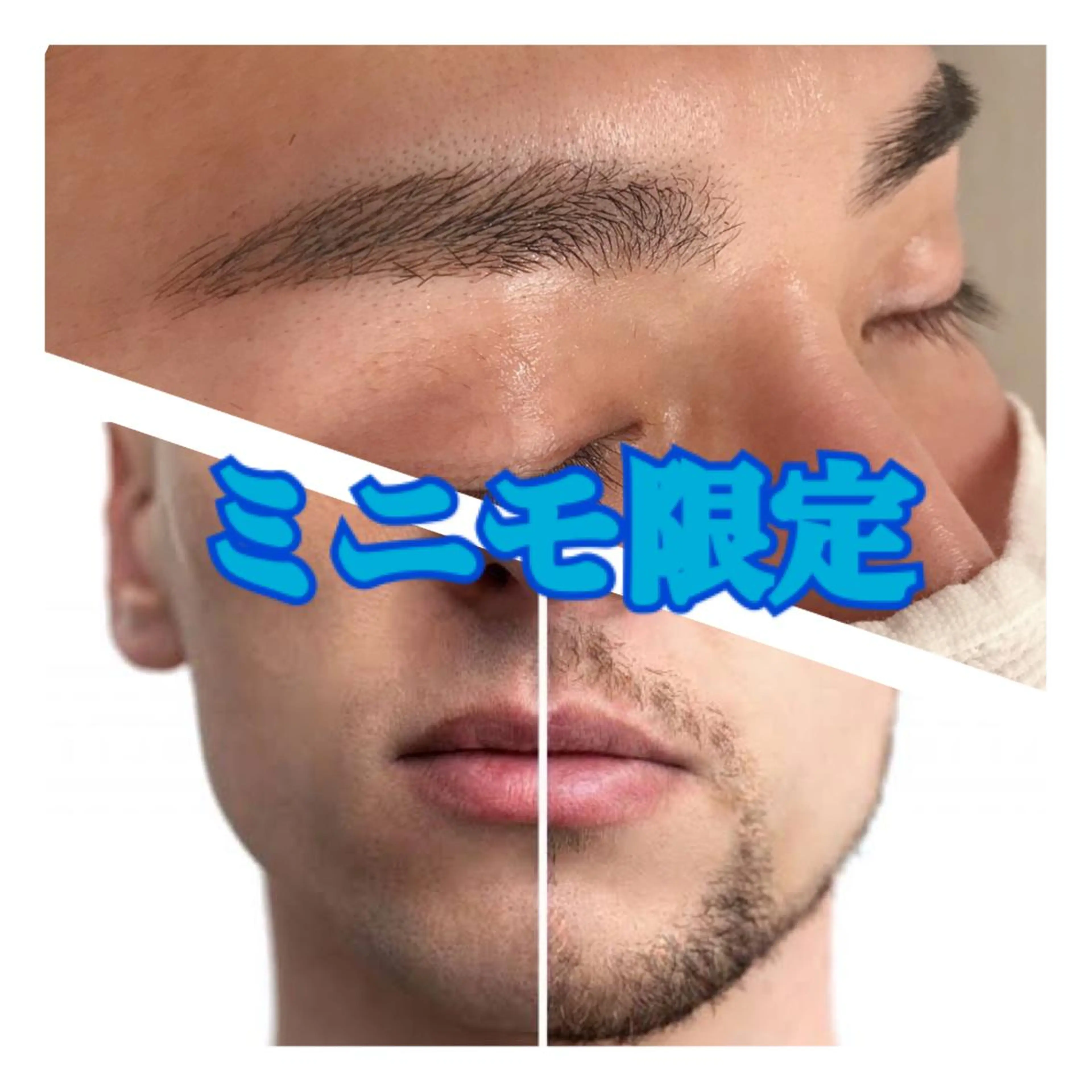 minimo限定🌸丸ごとヒゲ脱毛+眉ワックス(眉カット付)《通常》¥8,380 → 《限定価格》¥5,980❗️の写真