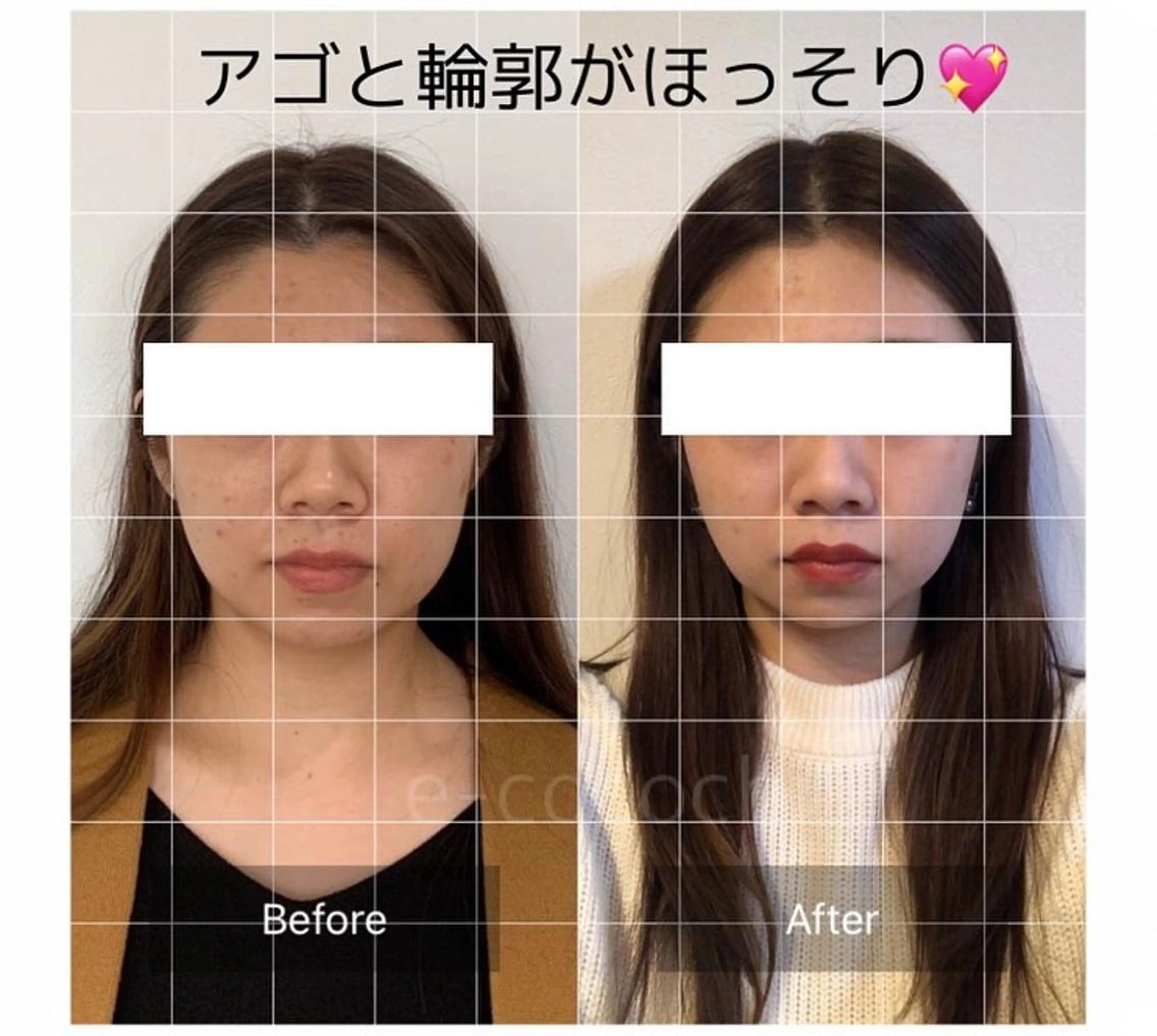 エステ リラク 小顔と ヘッドスパのお店のエステ・リラクイメージ