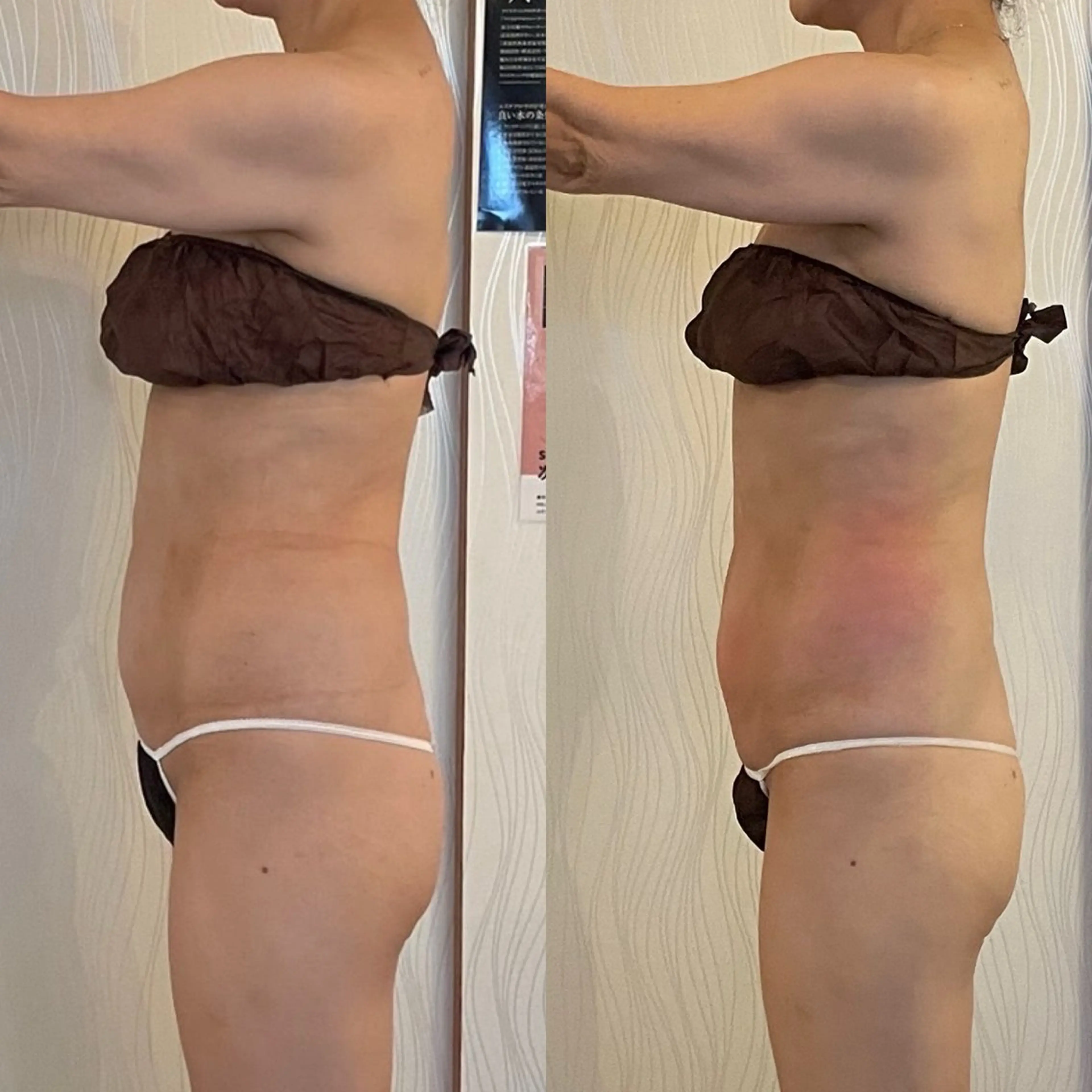 エステ JEIL michikoのエステ・リラクイメージ