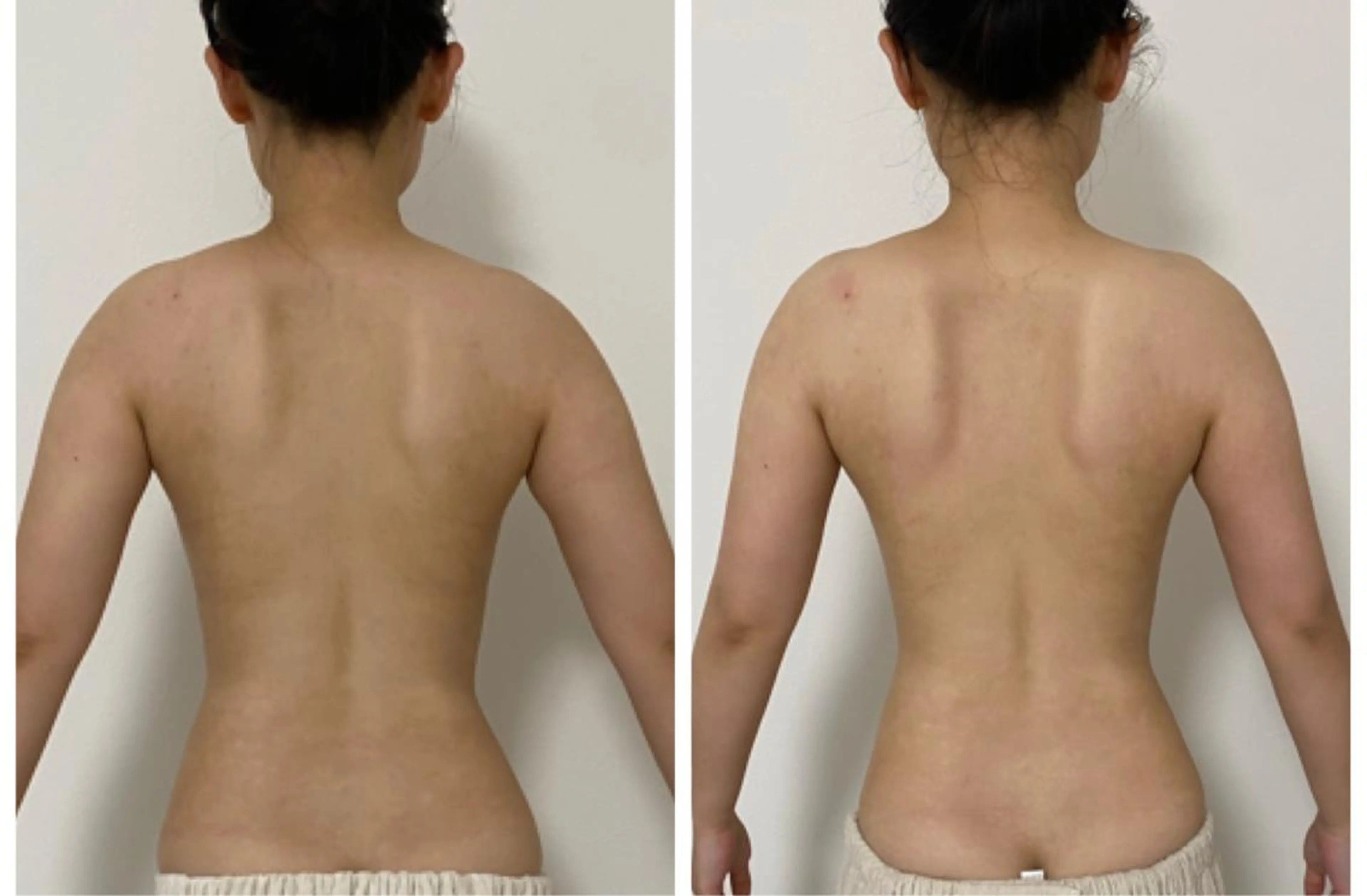 ✨オープン記念✨陶肌トリートメントハーブお背中🌿4g＋マッサージ付の写真