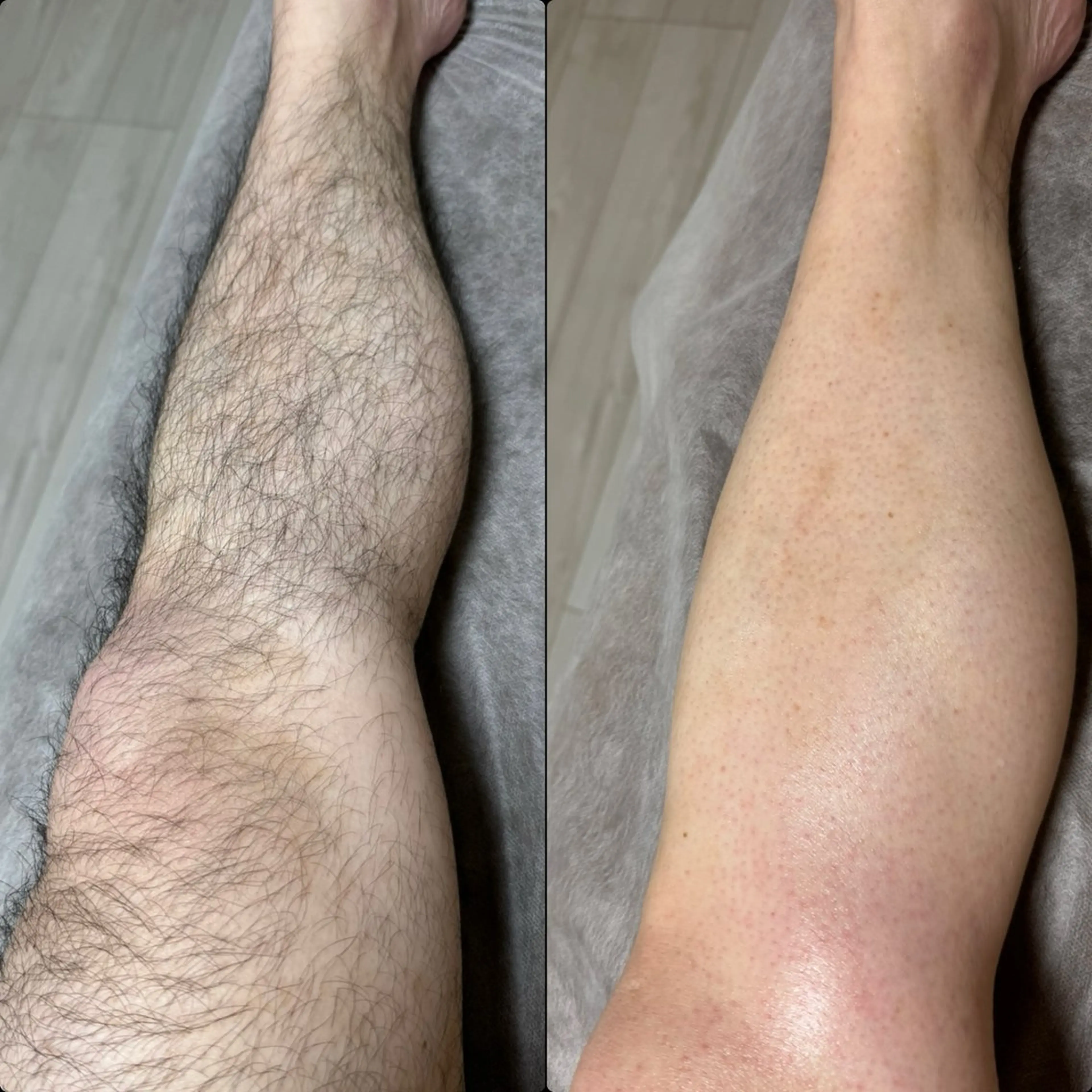 脱毛 六本木脱毛andS 店長Sachiのエステ・リラクイメージ