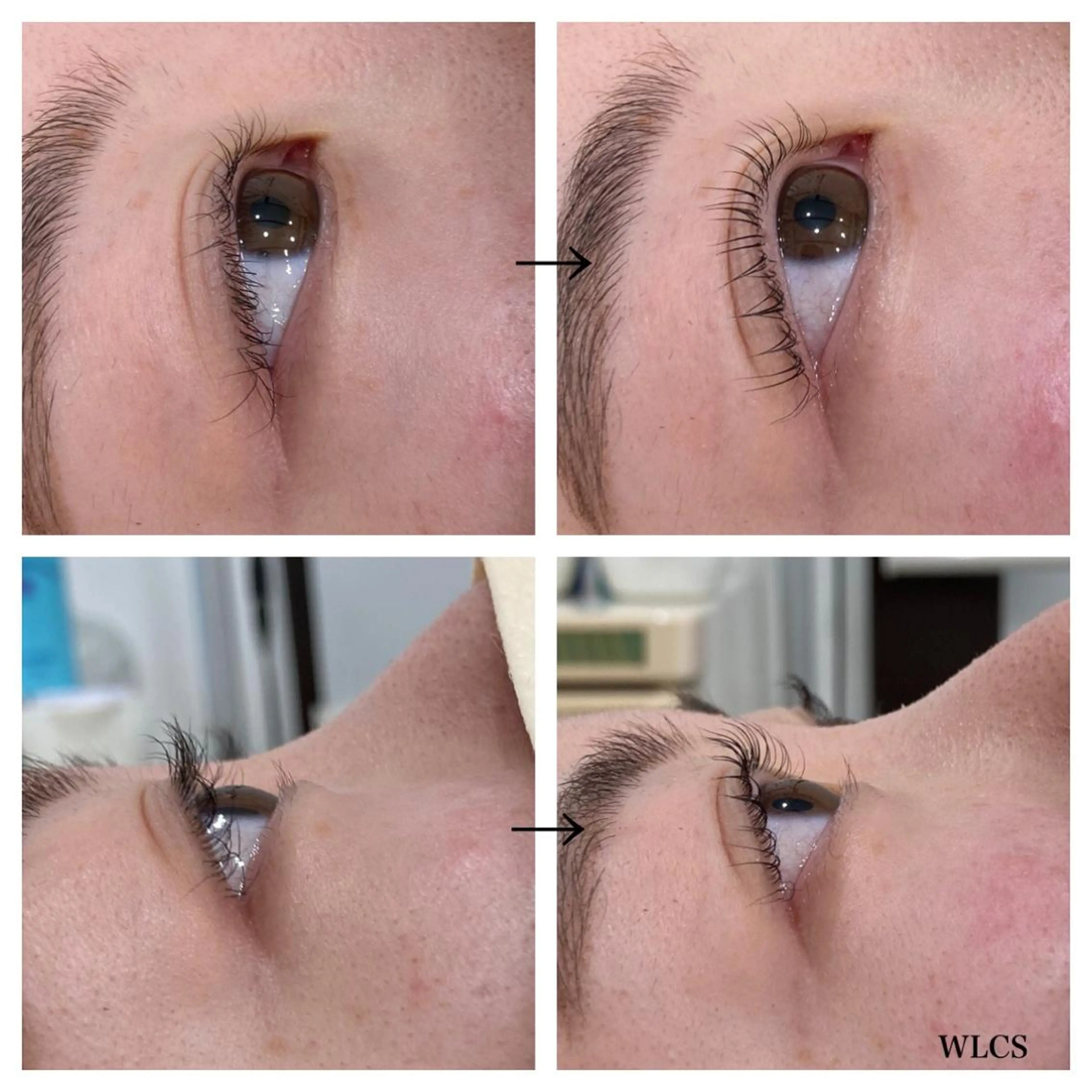 マツエク・マツパ ビューティー ミロワールのエステ・リラクイメージ