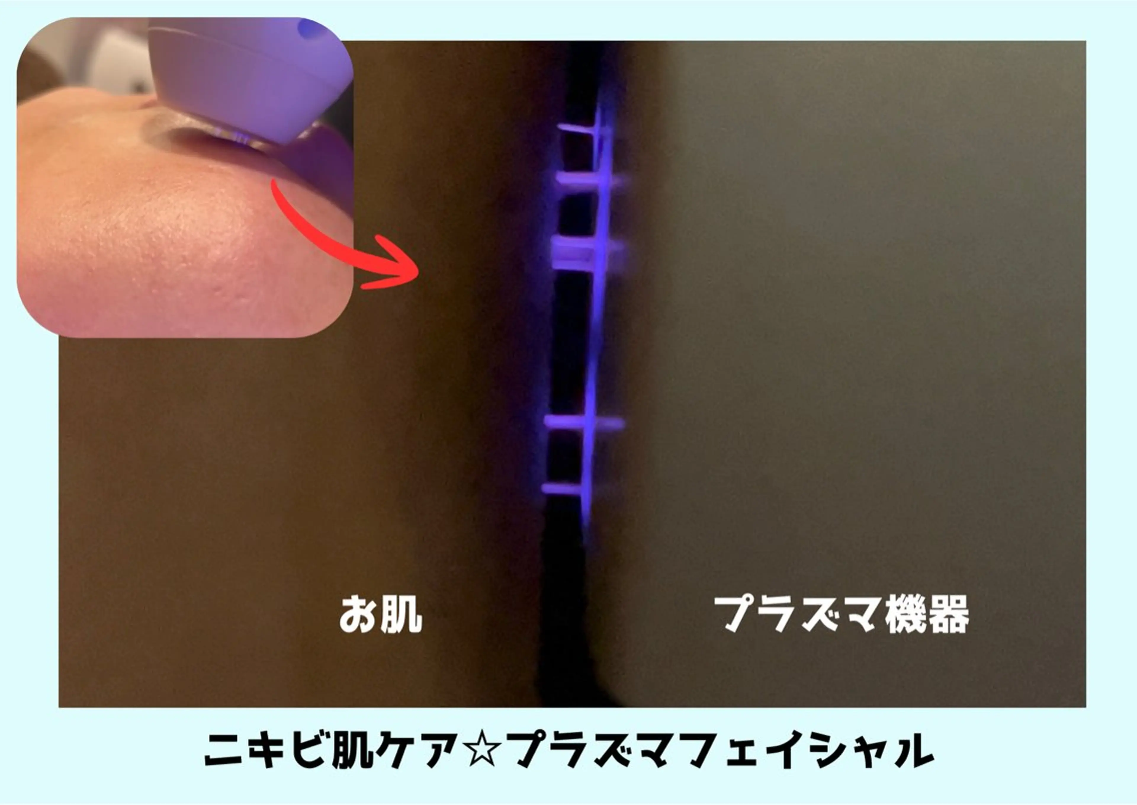 エステ Babel 〜都度払いサロン〜のエステ・リラクイメージ