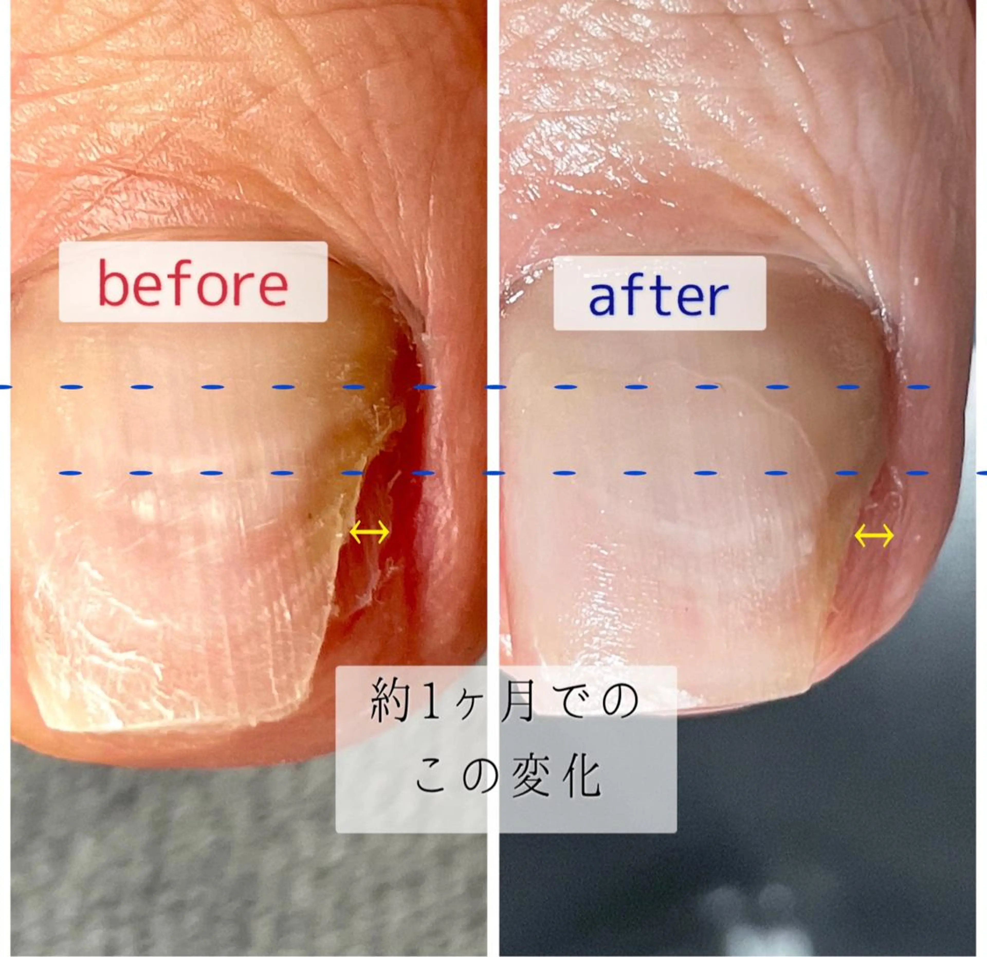 メンズ ネイル フットネイル ジェルネイル Chérinail 爪のお手入れのネイルデザイン