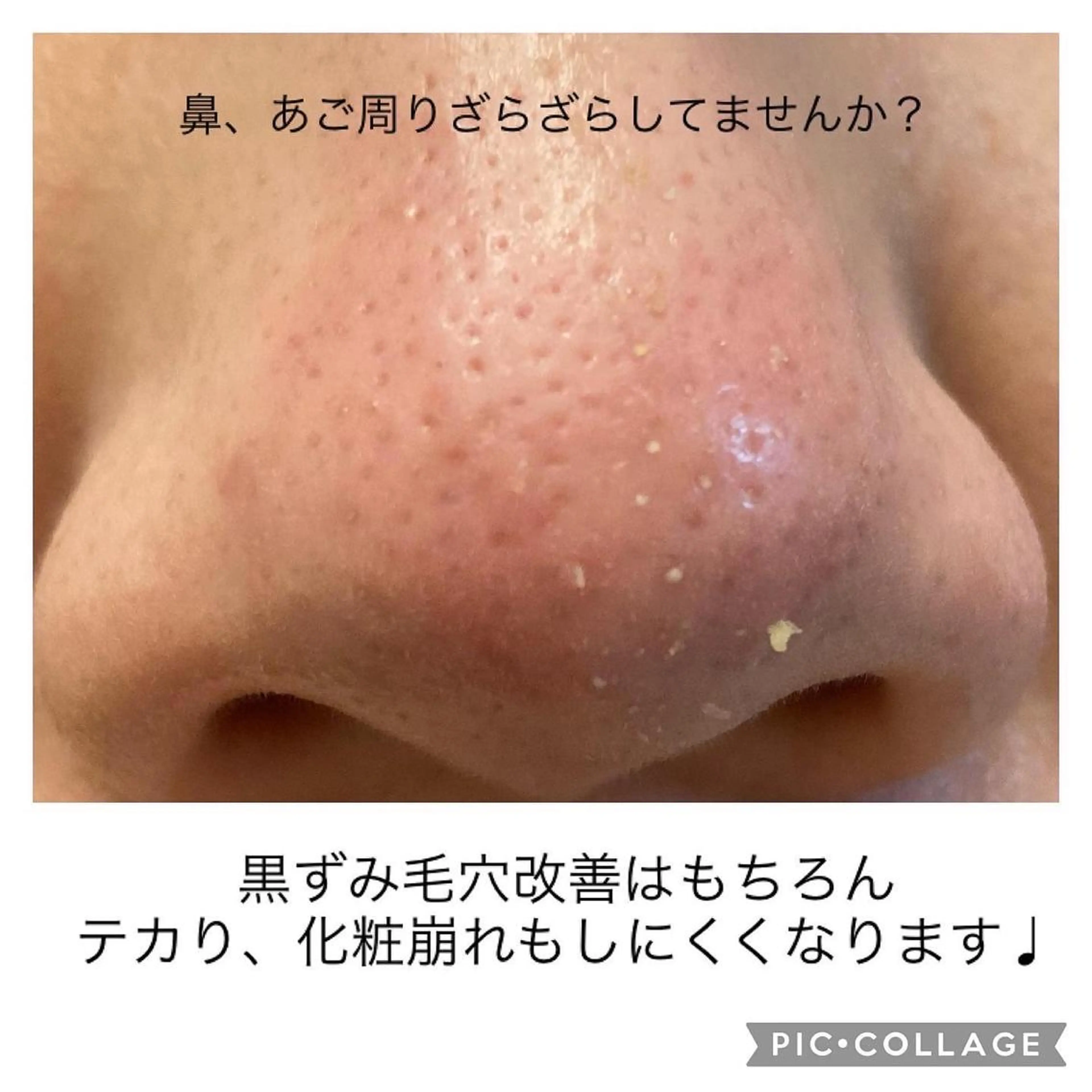 その他 毛穴ケア・肌質改善 徳川のエステ・リラクイメージ