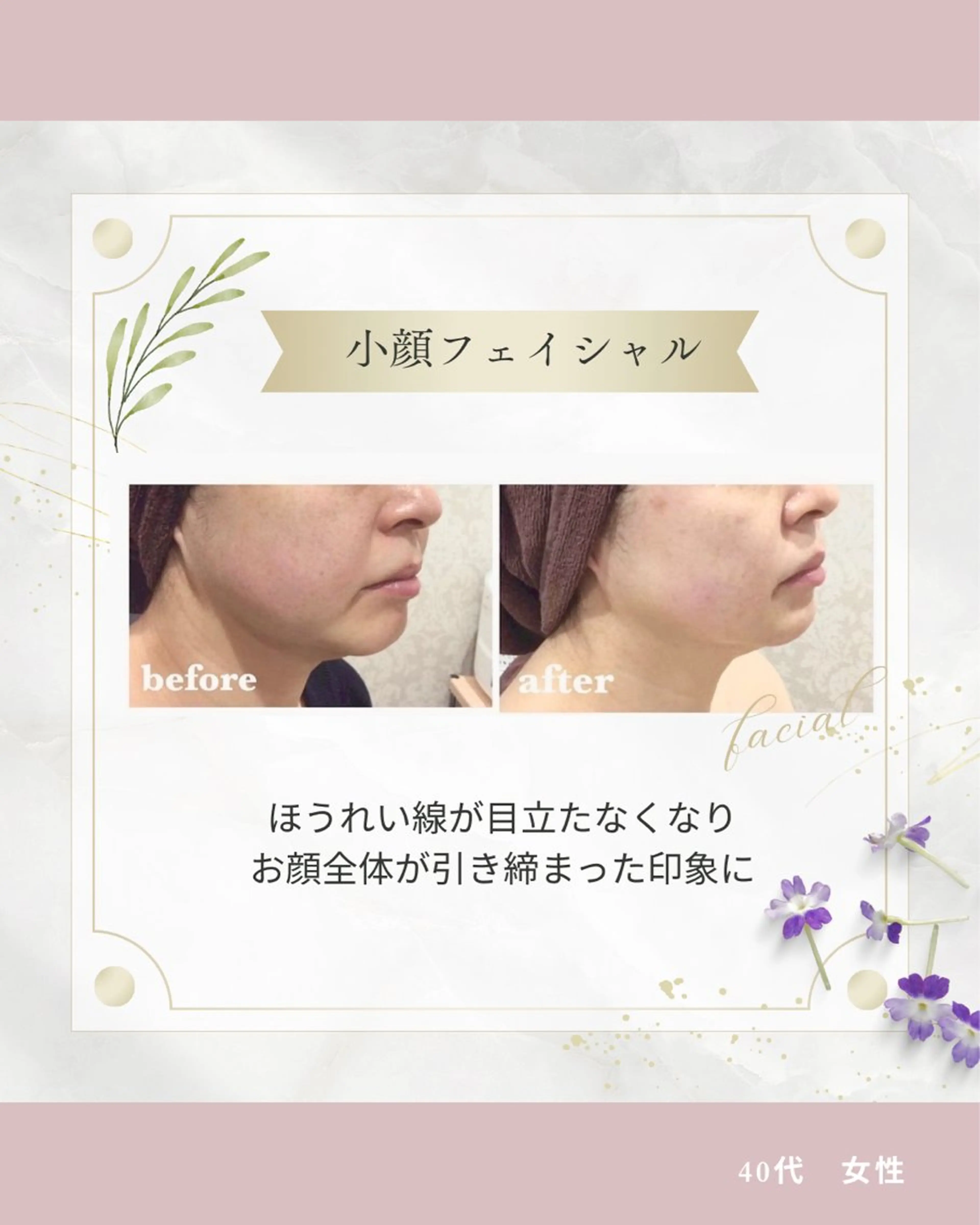 エステ 《 肌質×美肌 》 addissimoのエステ・リラクイメージ