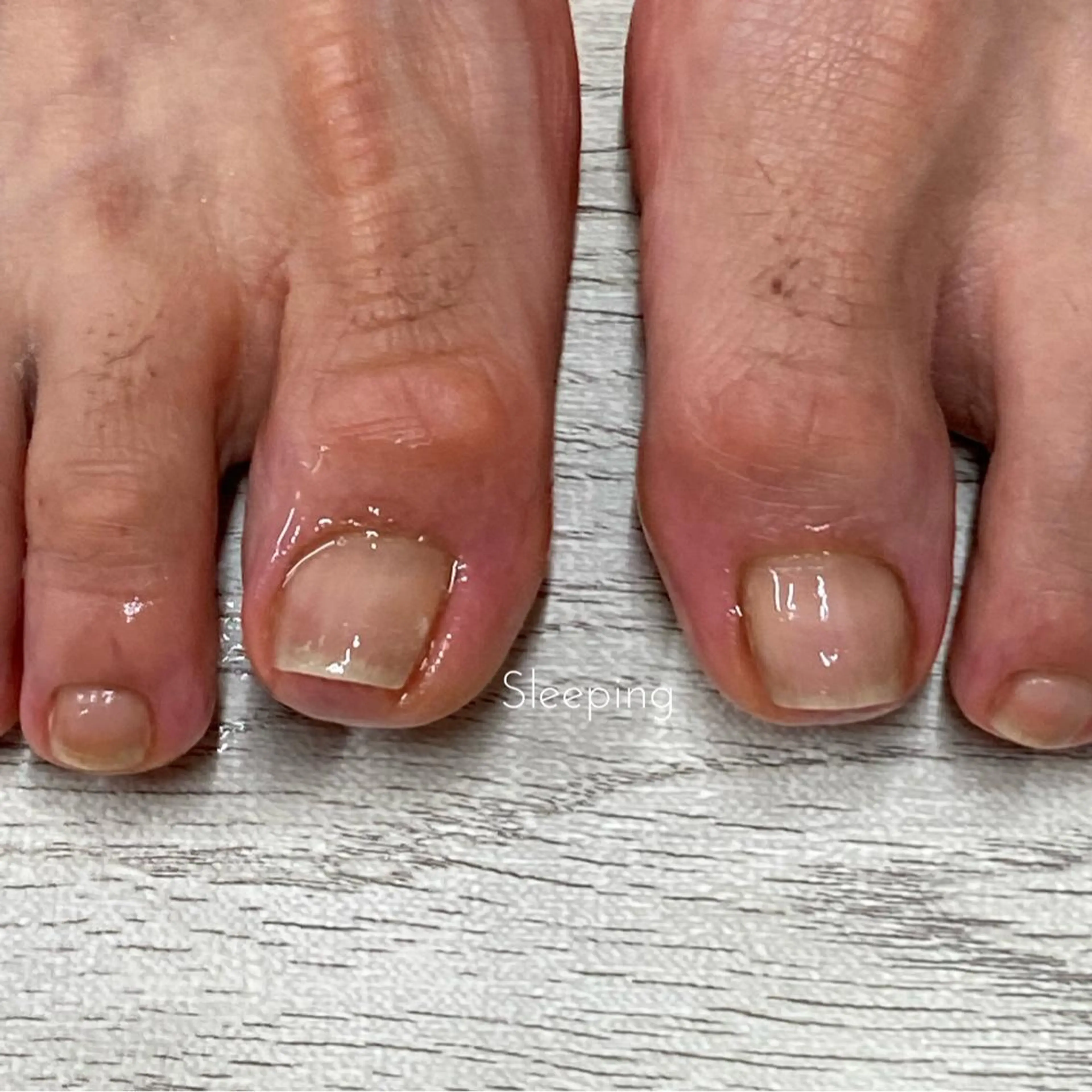 メンズ キッズ ネイル フットネイル 🌱 ま し お 🌱のその他イメージ