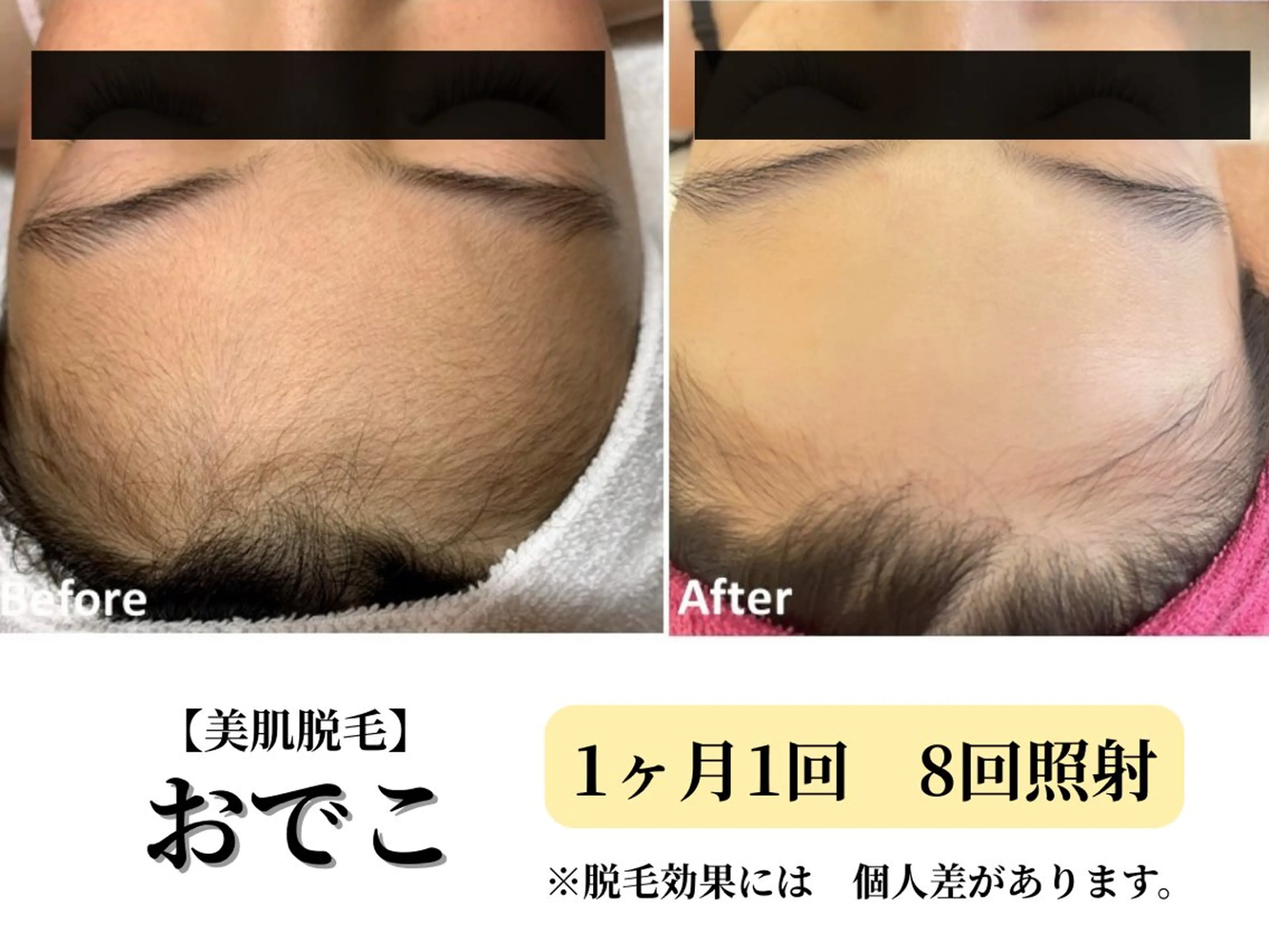 脱毛 Belle White所属・本格痩身＊肌質改善＊ BelleWhiteのエステ・リラクイメージ