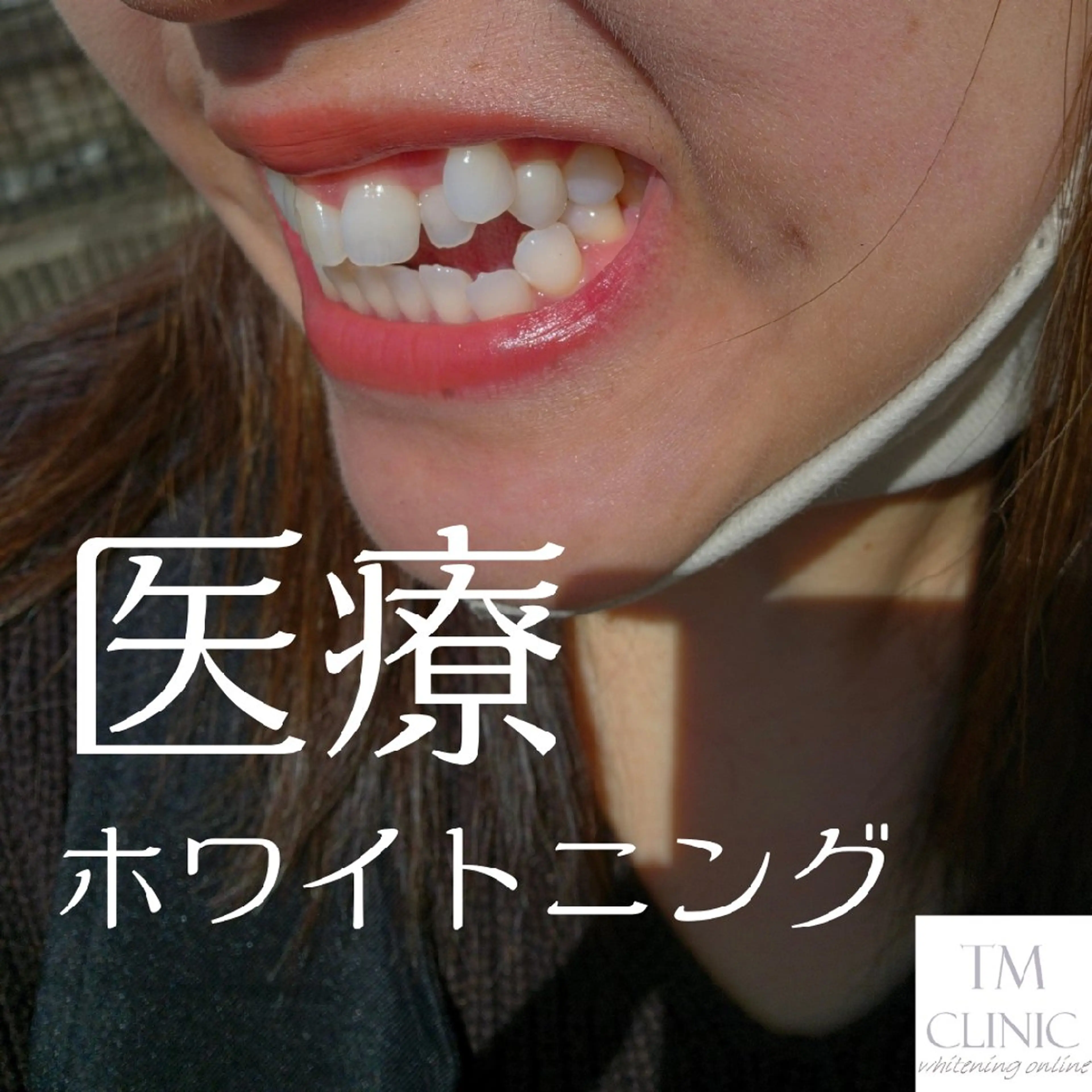 歯科提携セルフダック 宇都宮駒生店のエステ・リラクイメージ