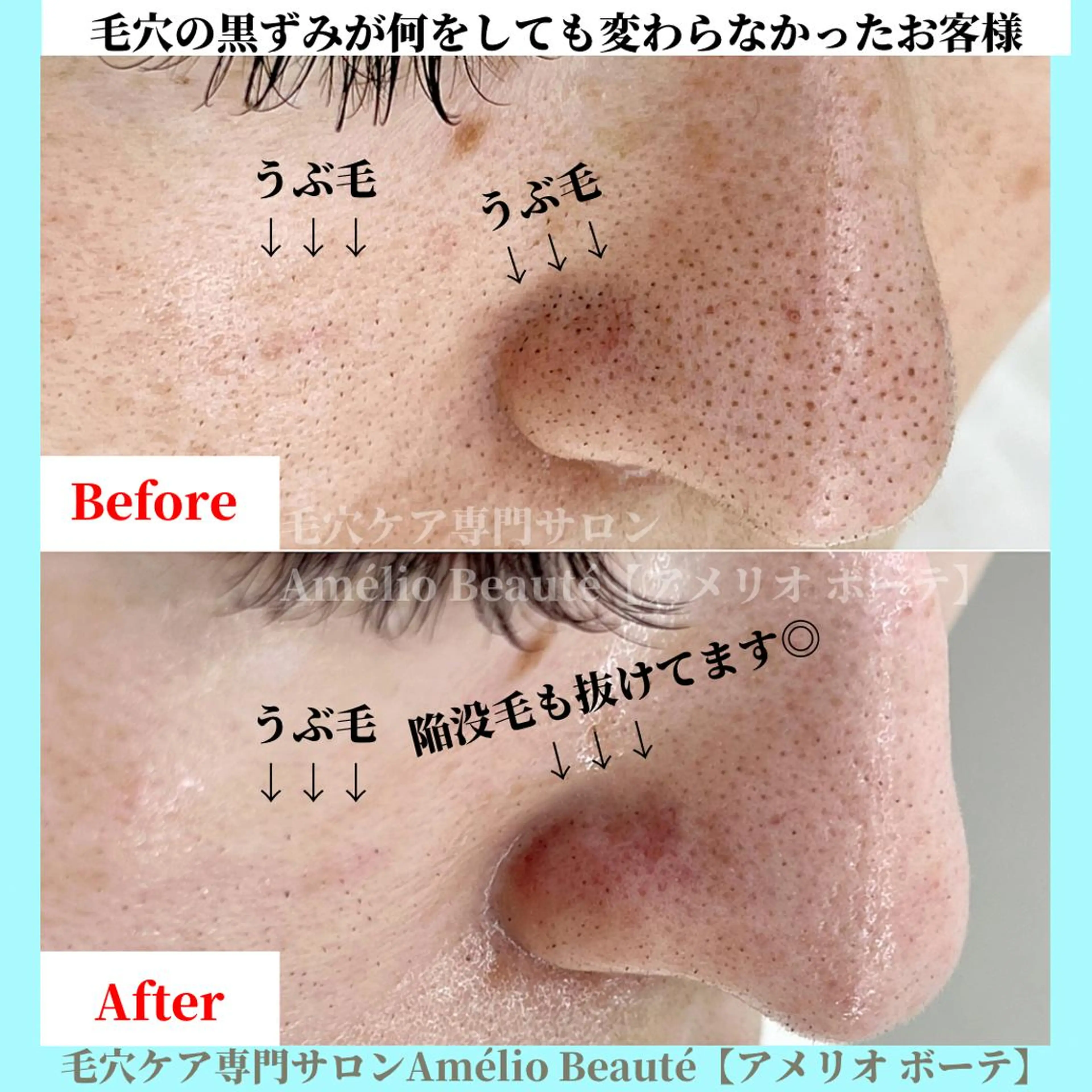 毛穴ケア専門サロン Amélio Beauté所属・毛穴ケア専門サロン アメリオボーテのその他イメージ