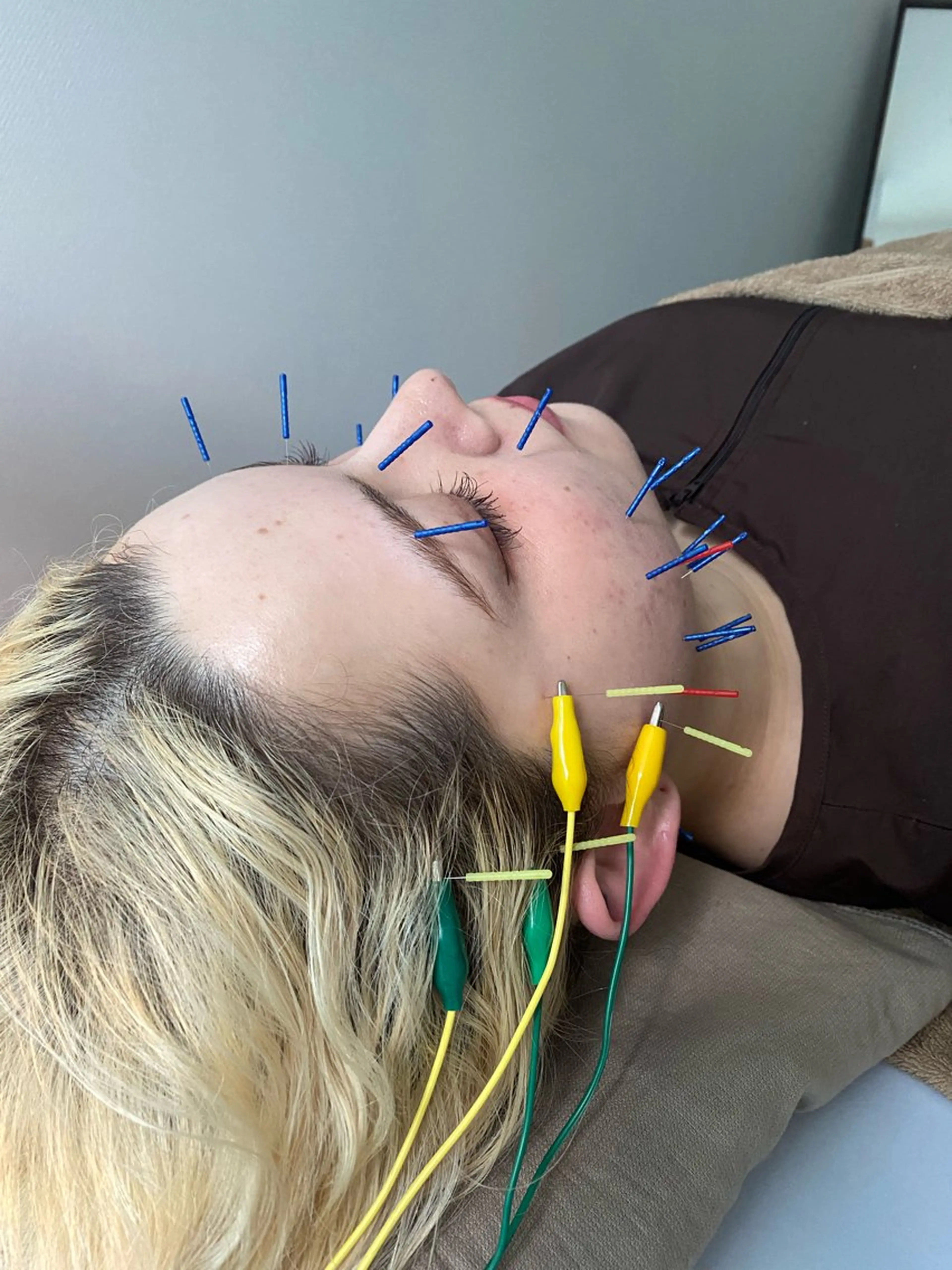 エステ リラク 整体×美容鍼灸 鍼灸師Miyanoのエステ・リラクイメージ