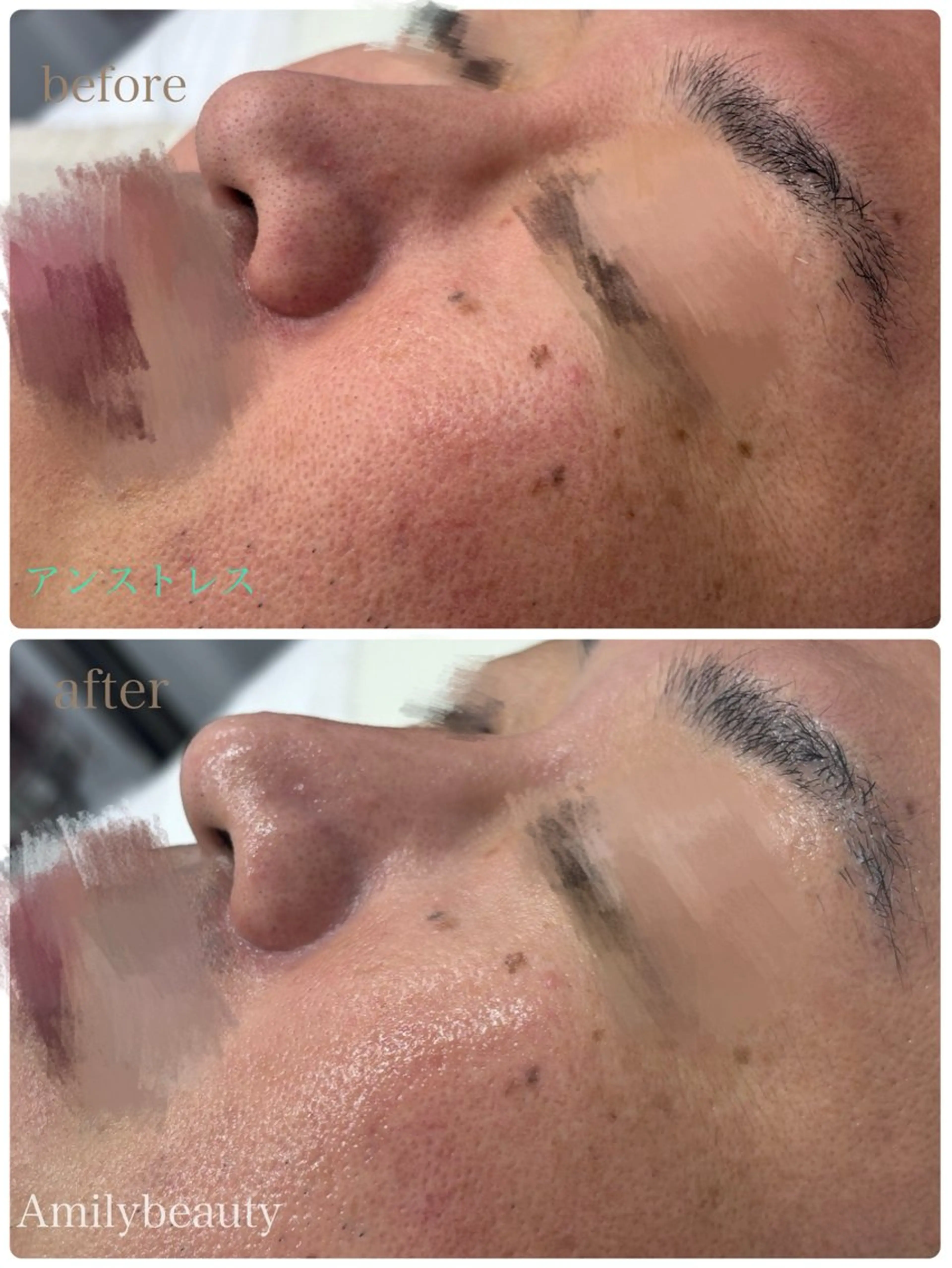 エステ Amilybeauty所属・Amily beauty 毛利のその他イメージ