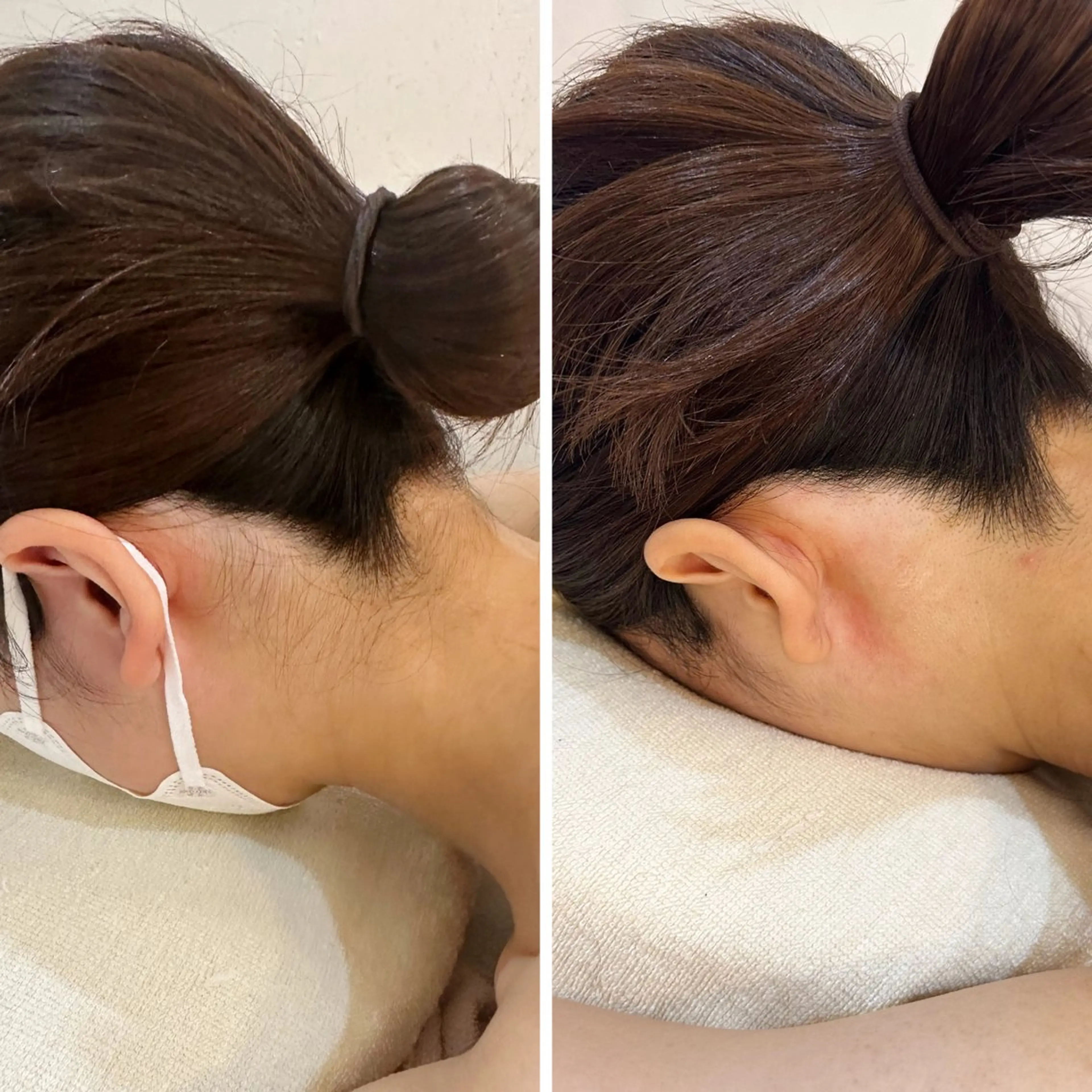 脱毛 うなじ脱毛/美肌脱毛 LABELのエステ・リラクイメージ