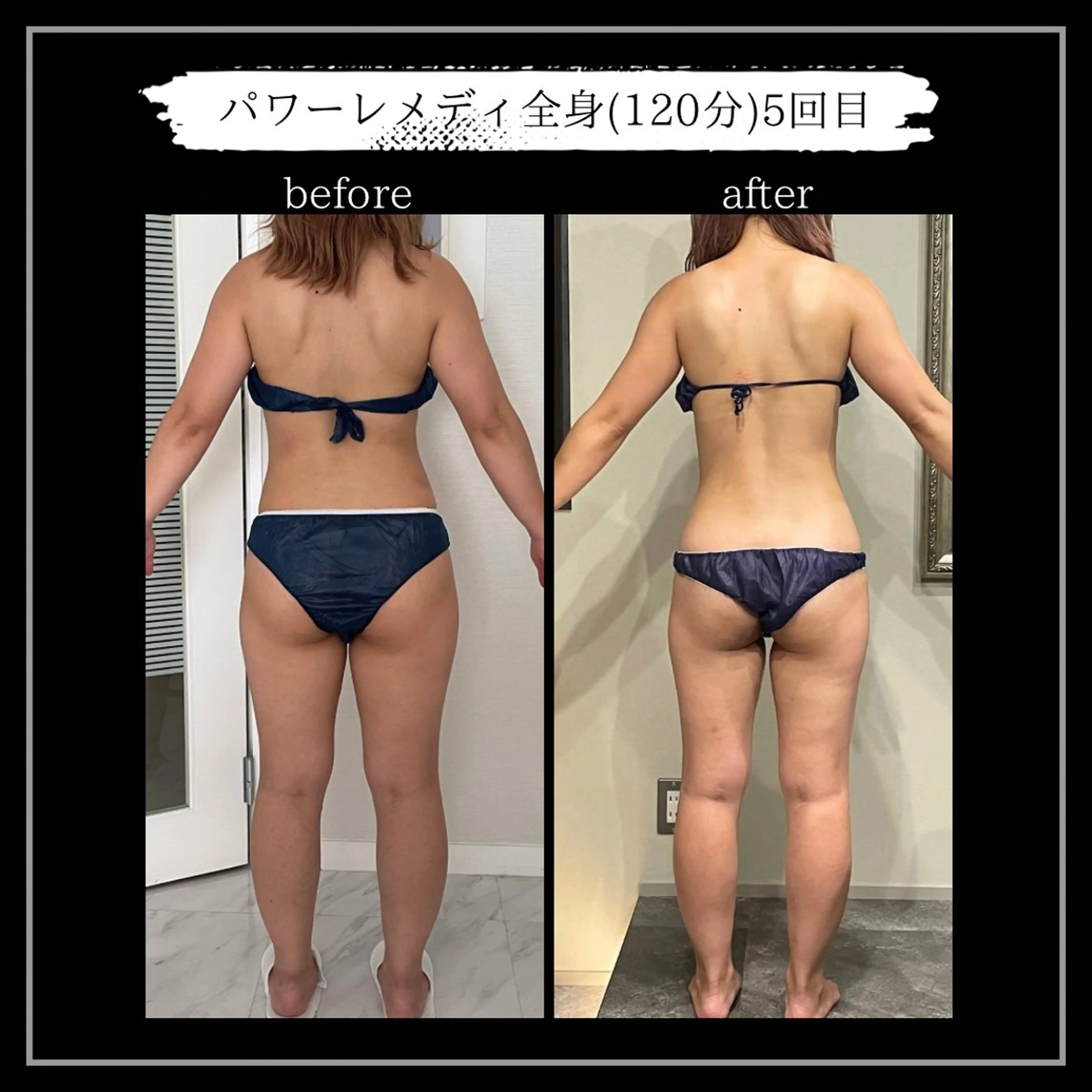 オフ:オン所属・オフ:オン 全身筋膜マッサージのエステ・リラクイメージ