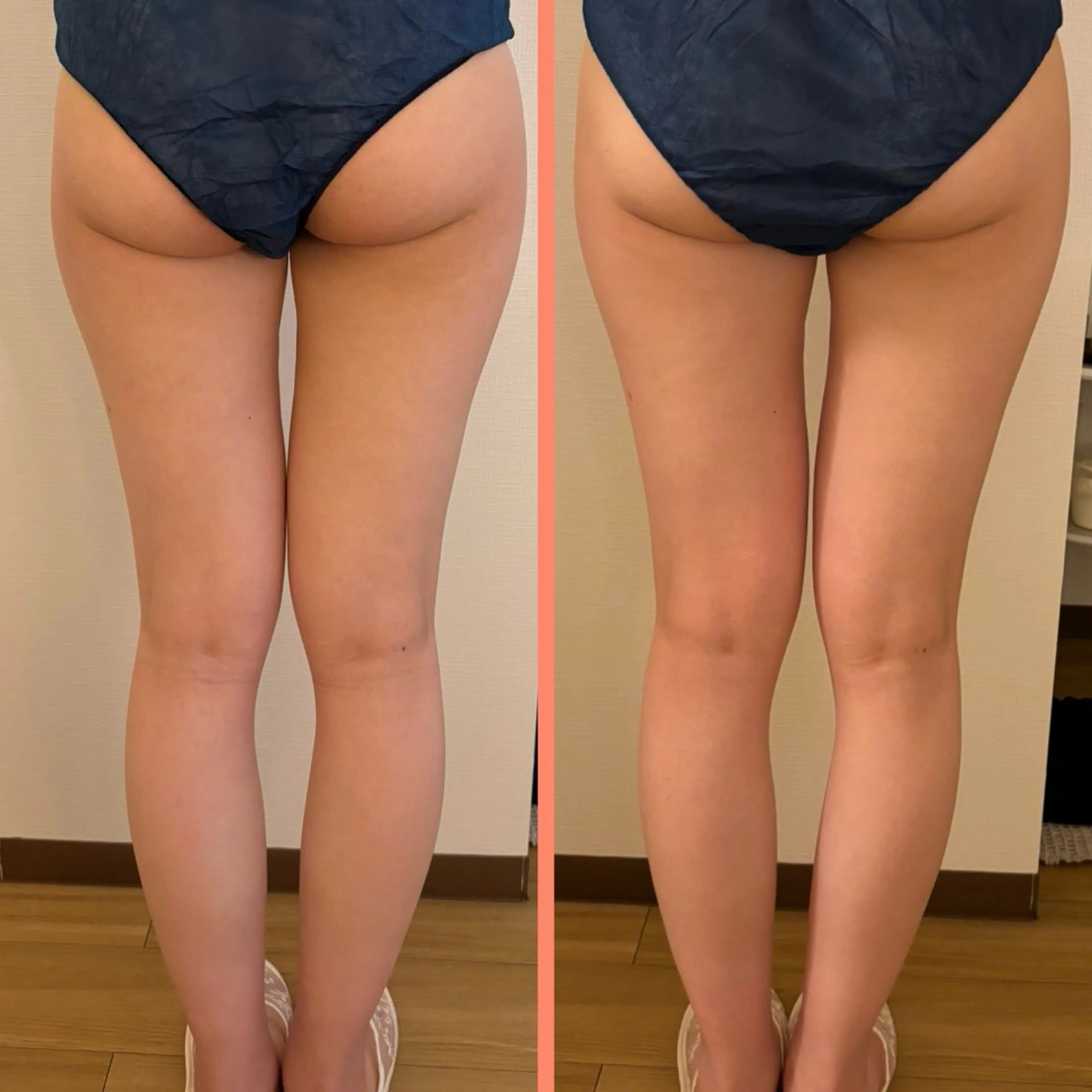 大阪大東市 / 体質・肌質改善サロン アンシャンテ所属・体質・肌質改善サロン アンシャンテのエステ・リラクイメージ