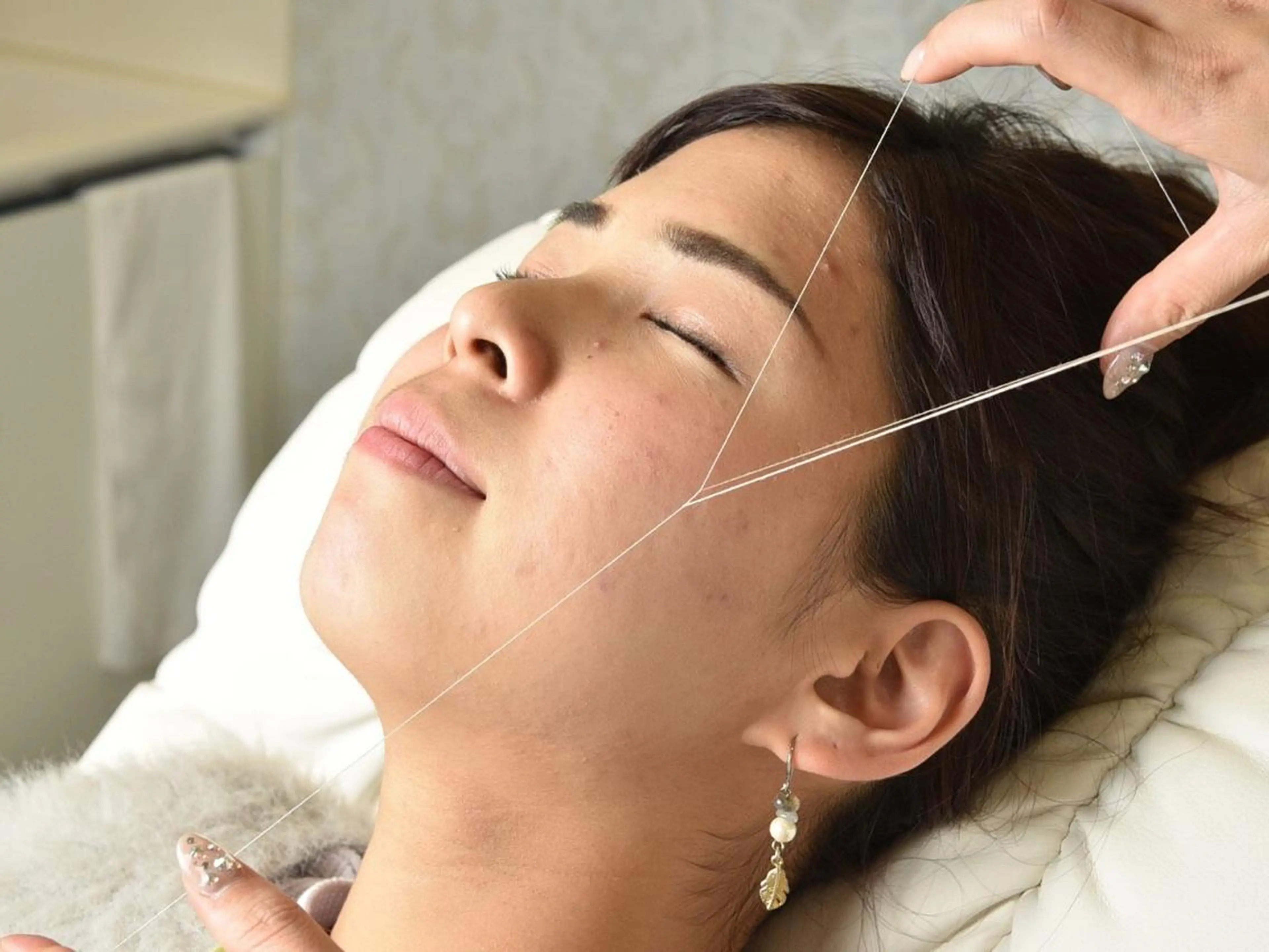 糸脱毛顔全体+保湿パック 1回コースの写真