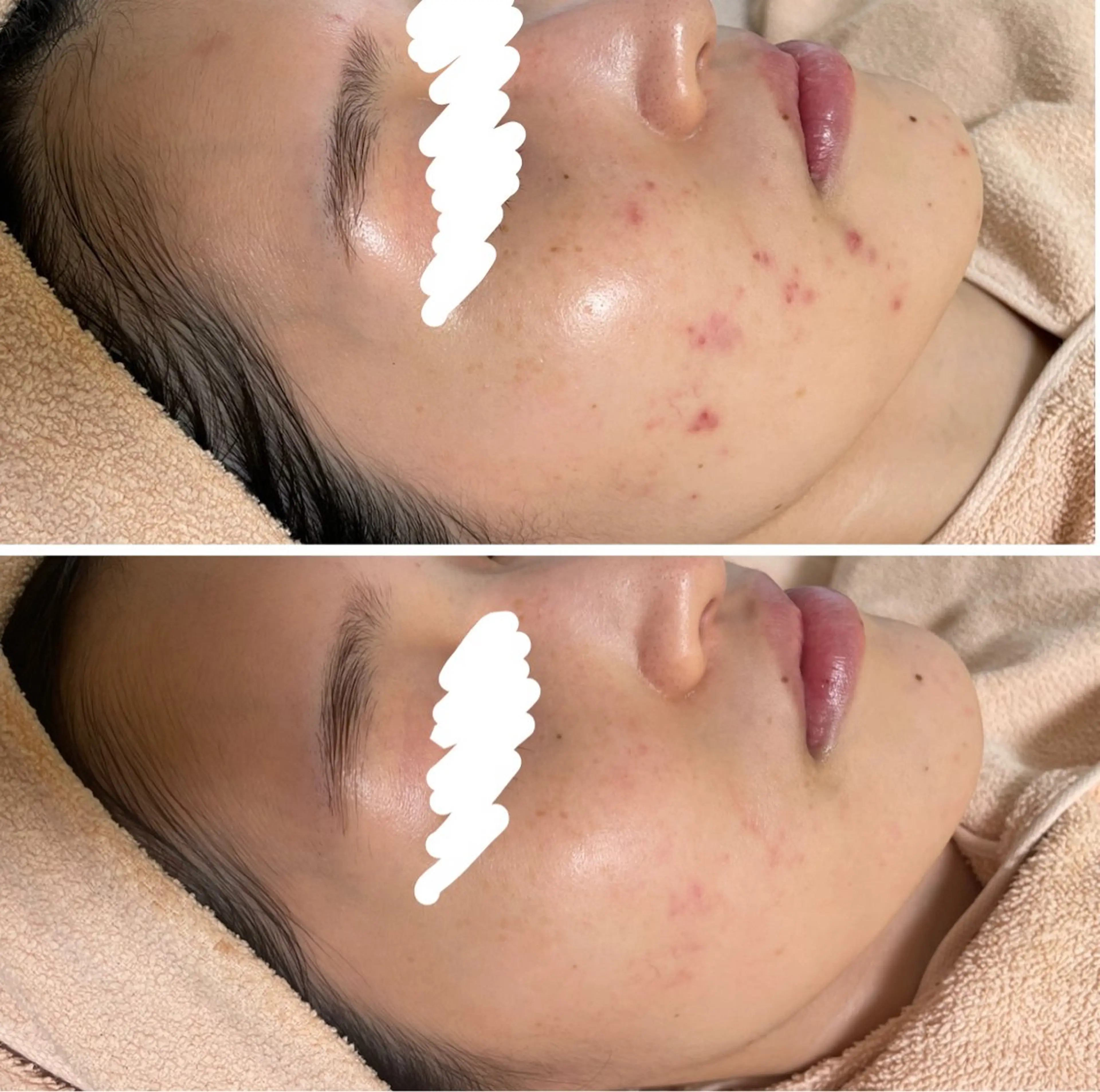 エステ ニキビ&跡改善サロン オーナー光木のエステ・リラクイメージ