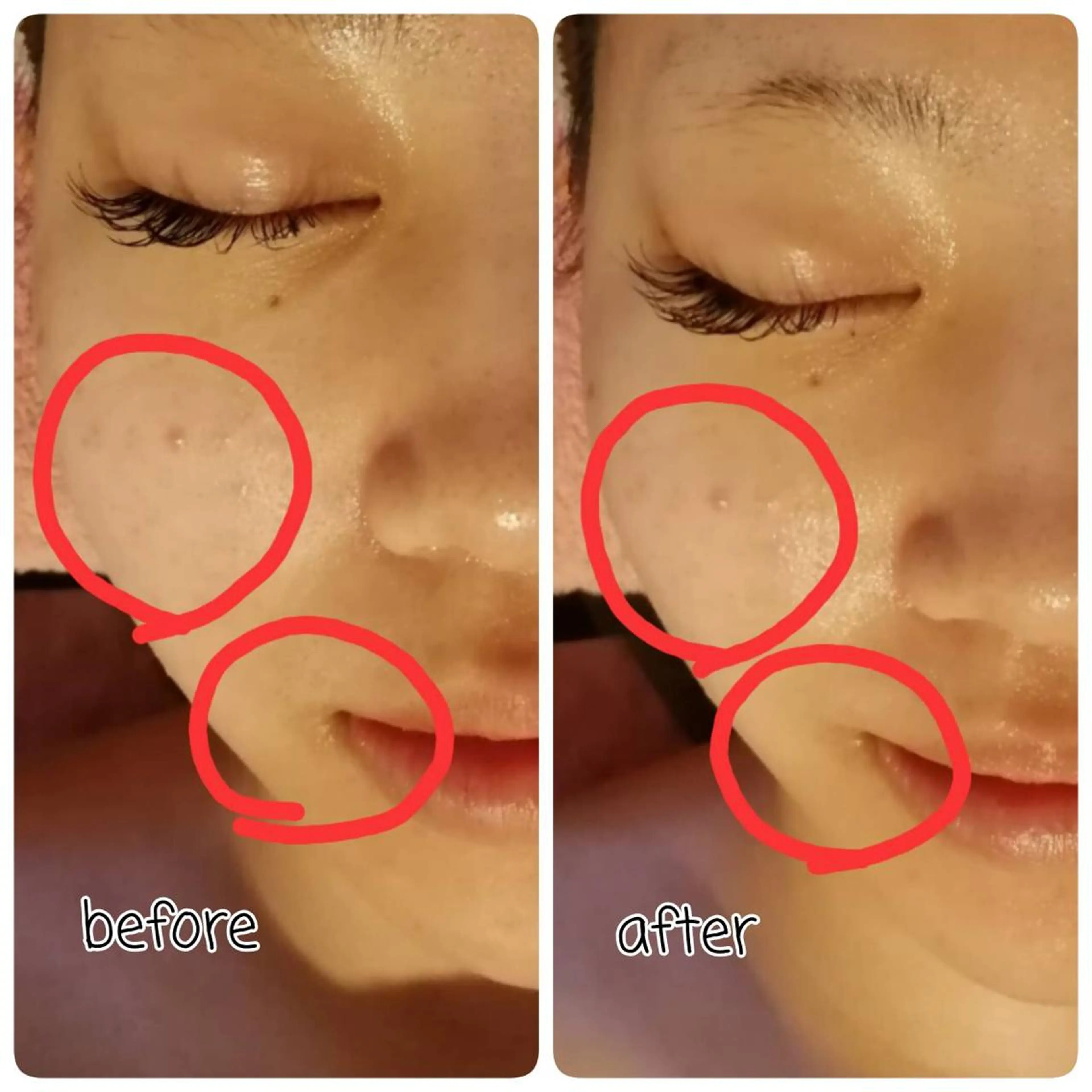 未病ケアサロン　EMINY所属・未病ケアサロン EMINY☺︎勝俣のエステ・リラクイメージ