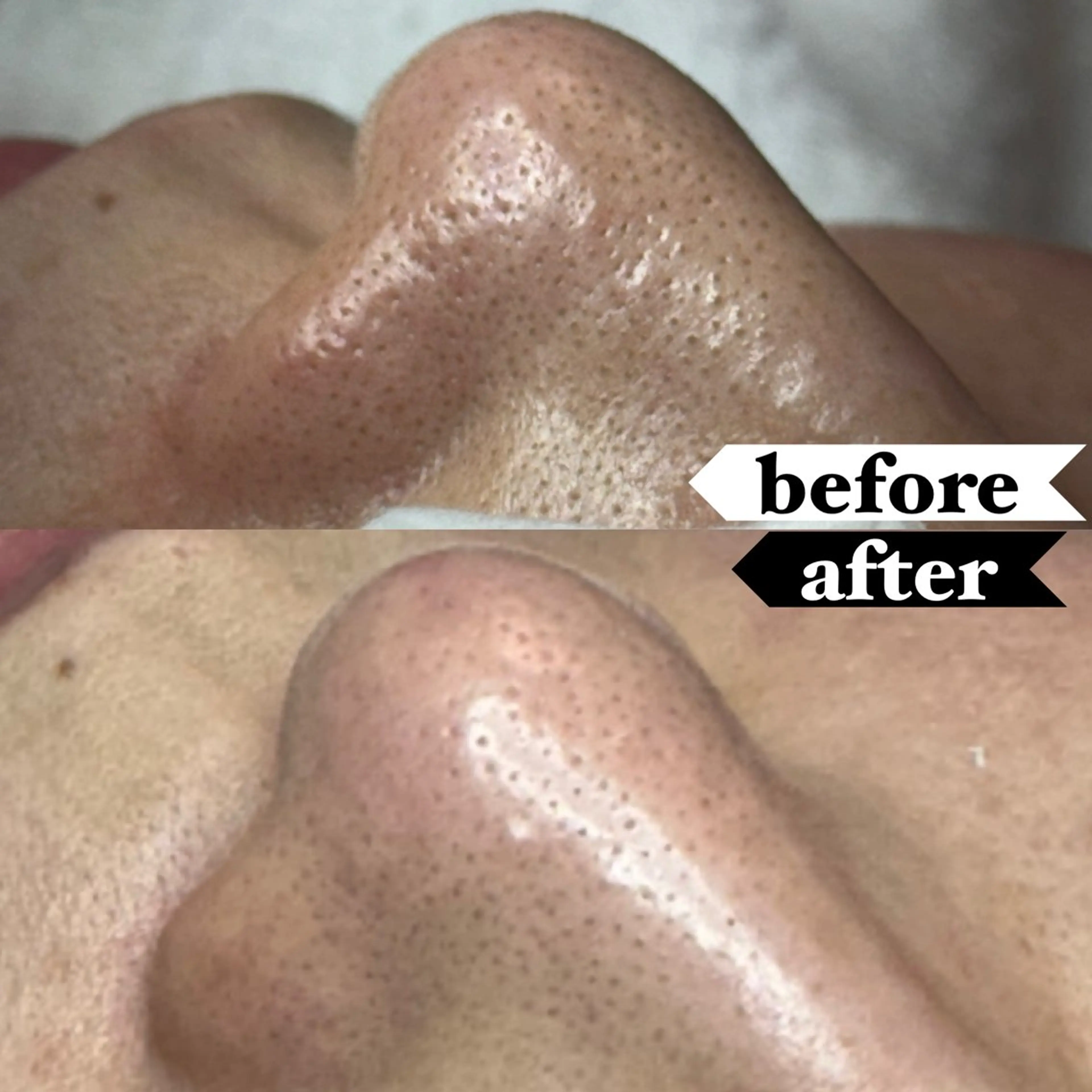 毛穴専門サロン ライカブルーのエステ・リラクイメージ