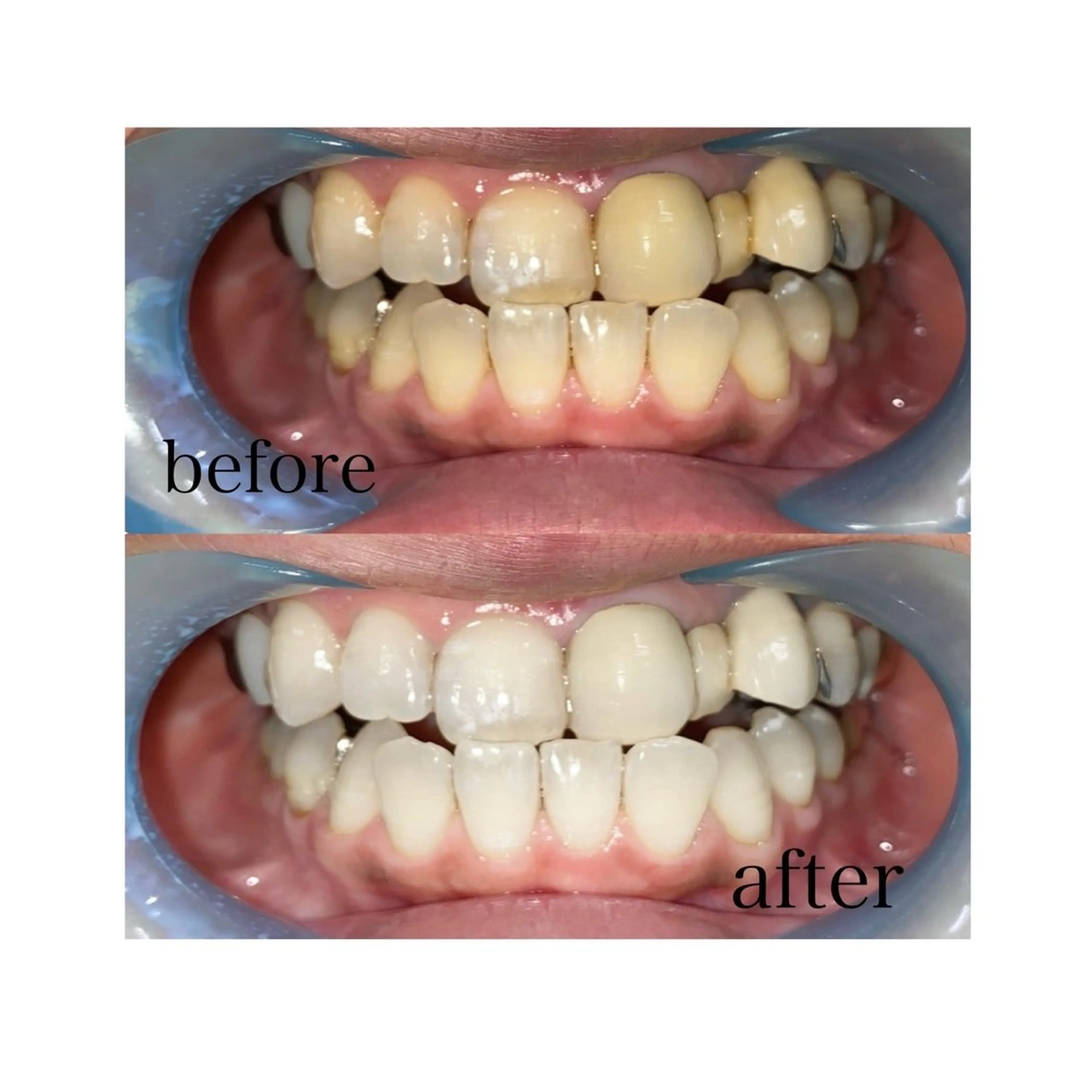 メンズ ホワイトニングサロン SHILONのエステ・リラクイメージ