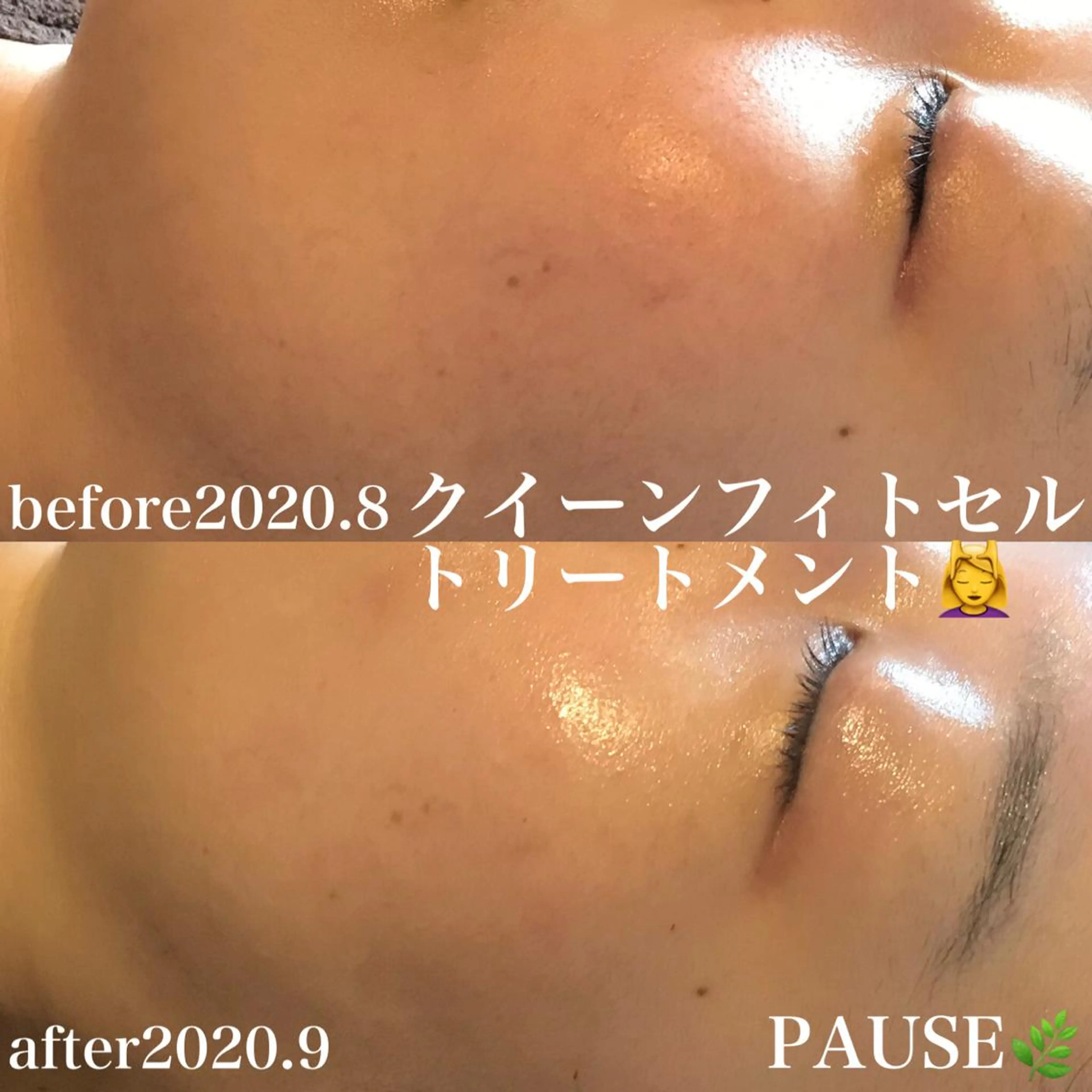 エステ 浜野 恵美のエステ・リラクイメージ