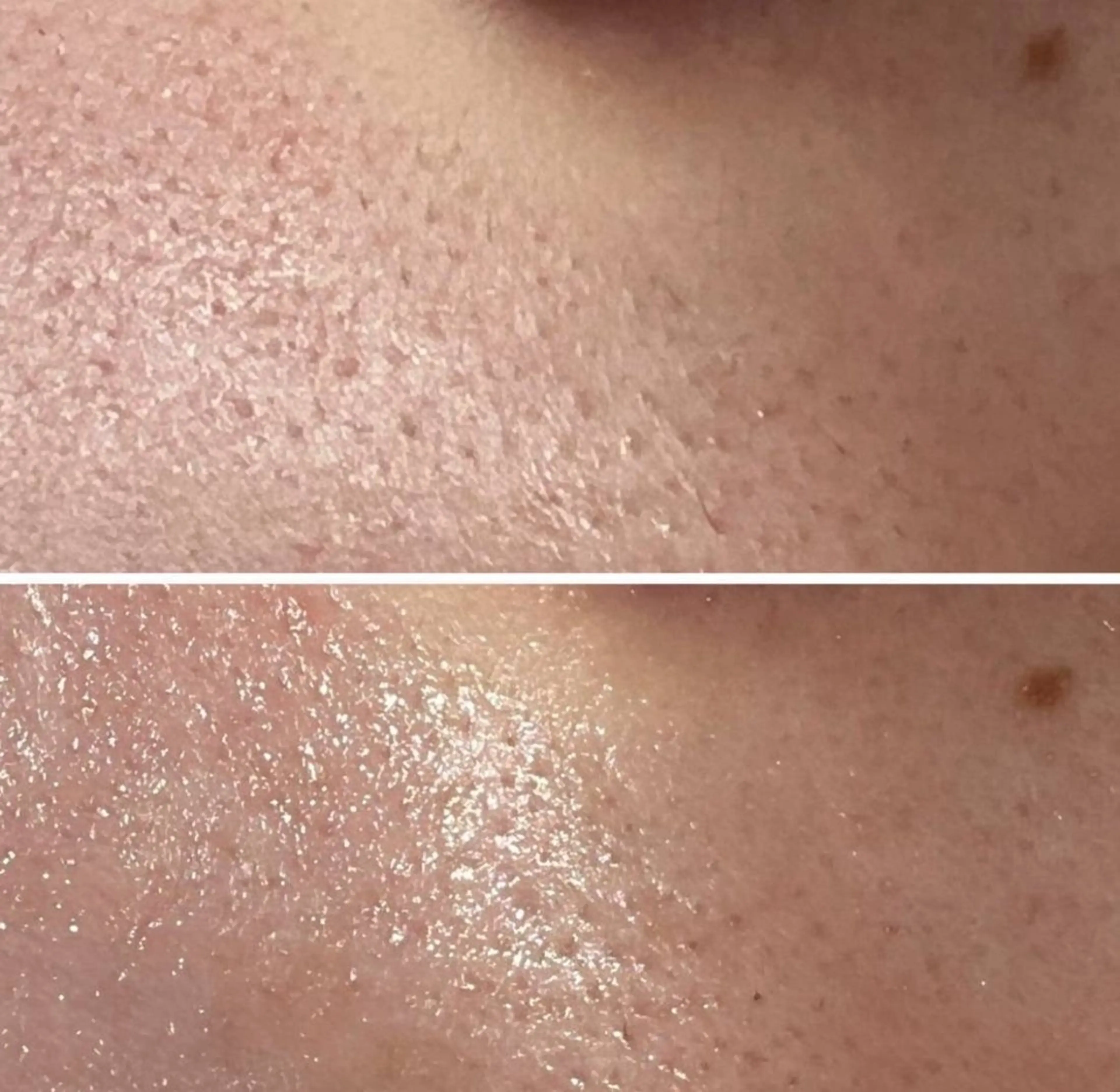 ADDICT中目黒店所属・毛穴洗浄/毛穴ケア 🌿中目黒🌿のエステ・リラクイメージ