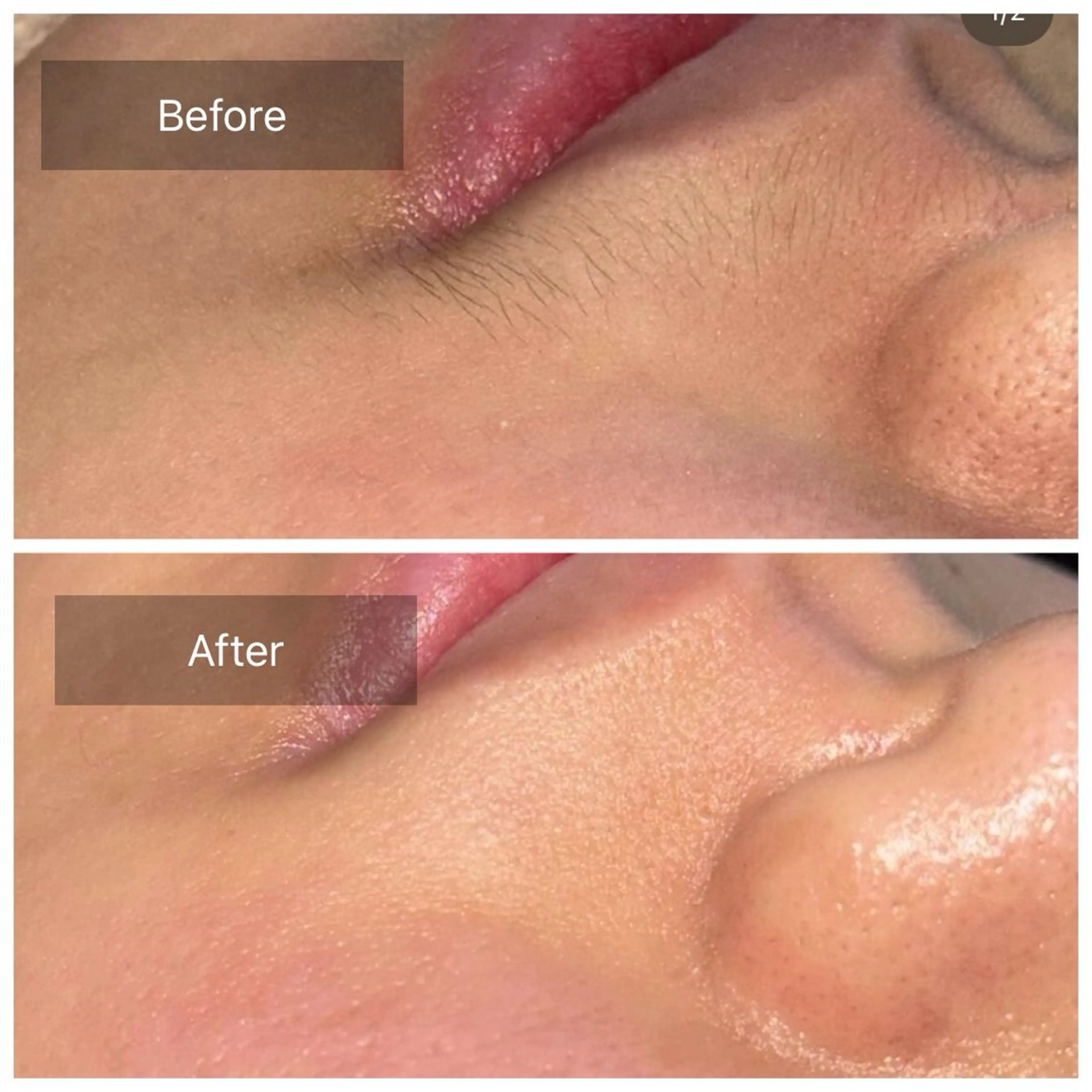 毛穴レス！フェイスワックス🫧１度で効果を感じられます🥚✨ (シートパック付／高保湿モデリングパック変更可)の写真