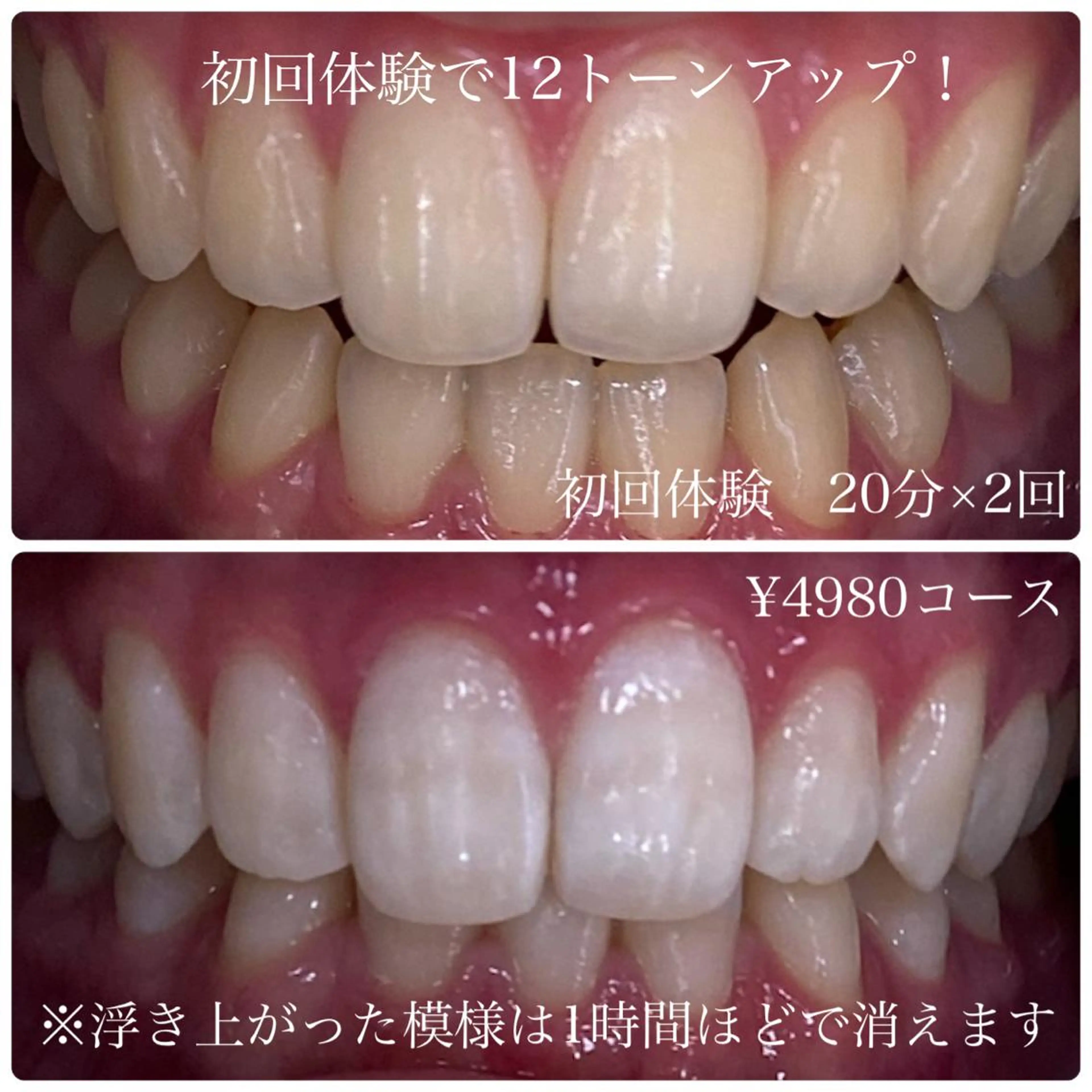 その他 ホワイトニングルーム　川崎店所属・ホワイトニング ルーム　川崎店のその他イメージ