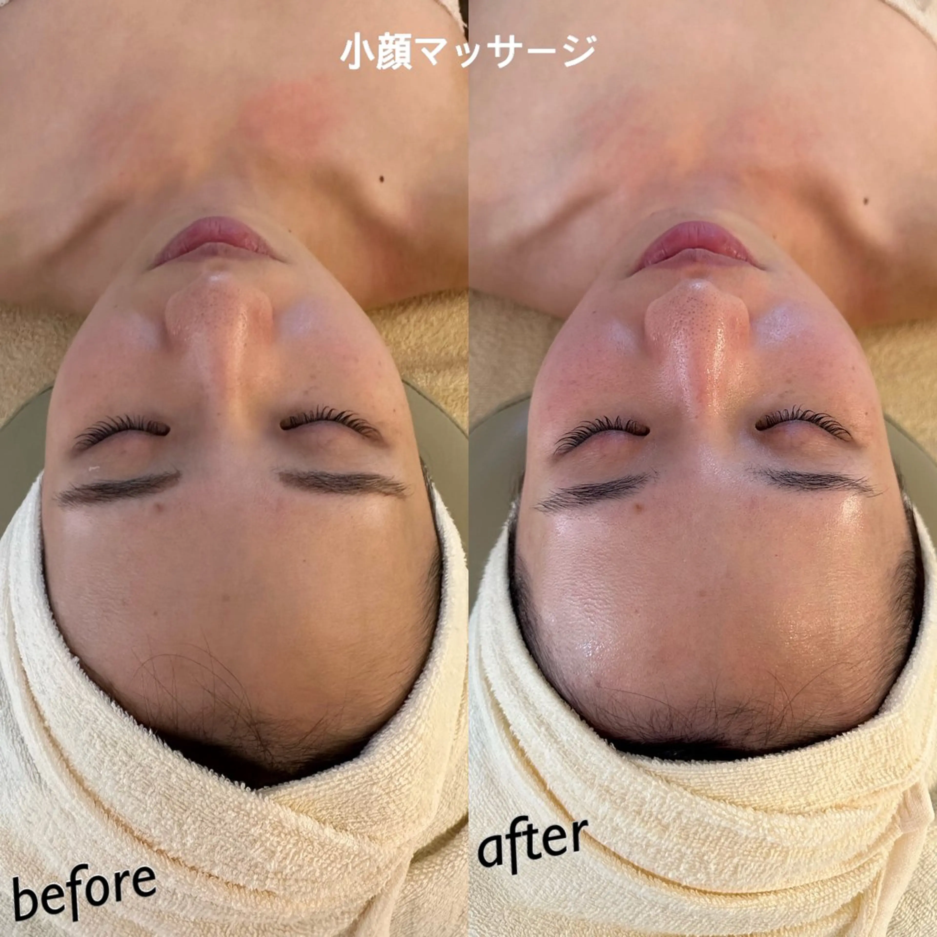 うなじ脱毛/美肌脱毛 LABELのエステ・リラクイメージ