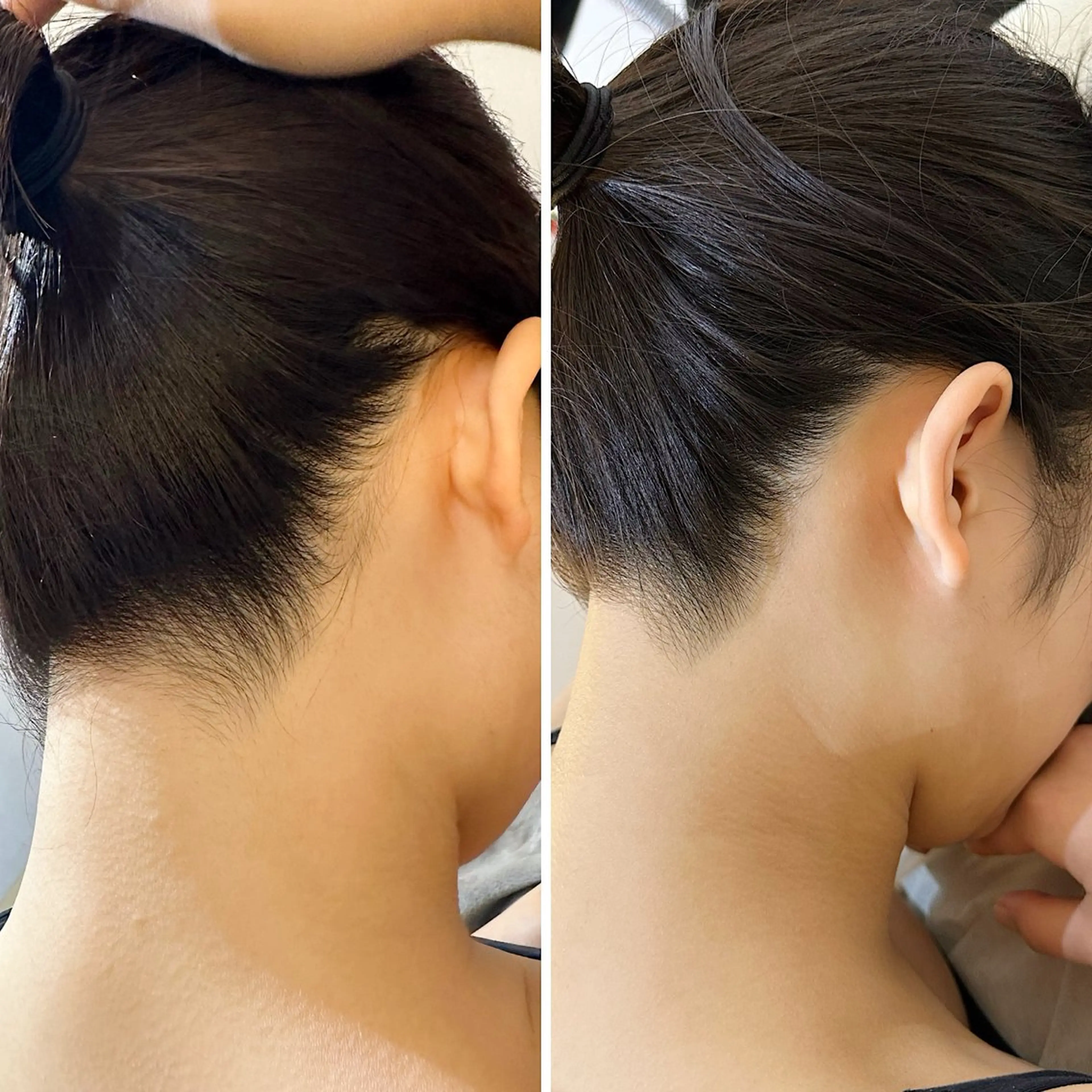 脱毛 うなじ脱毛/美肌脱毛 LABELのエステ・リラクイメージ