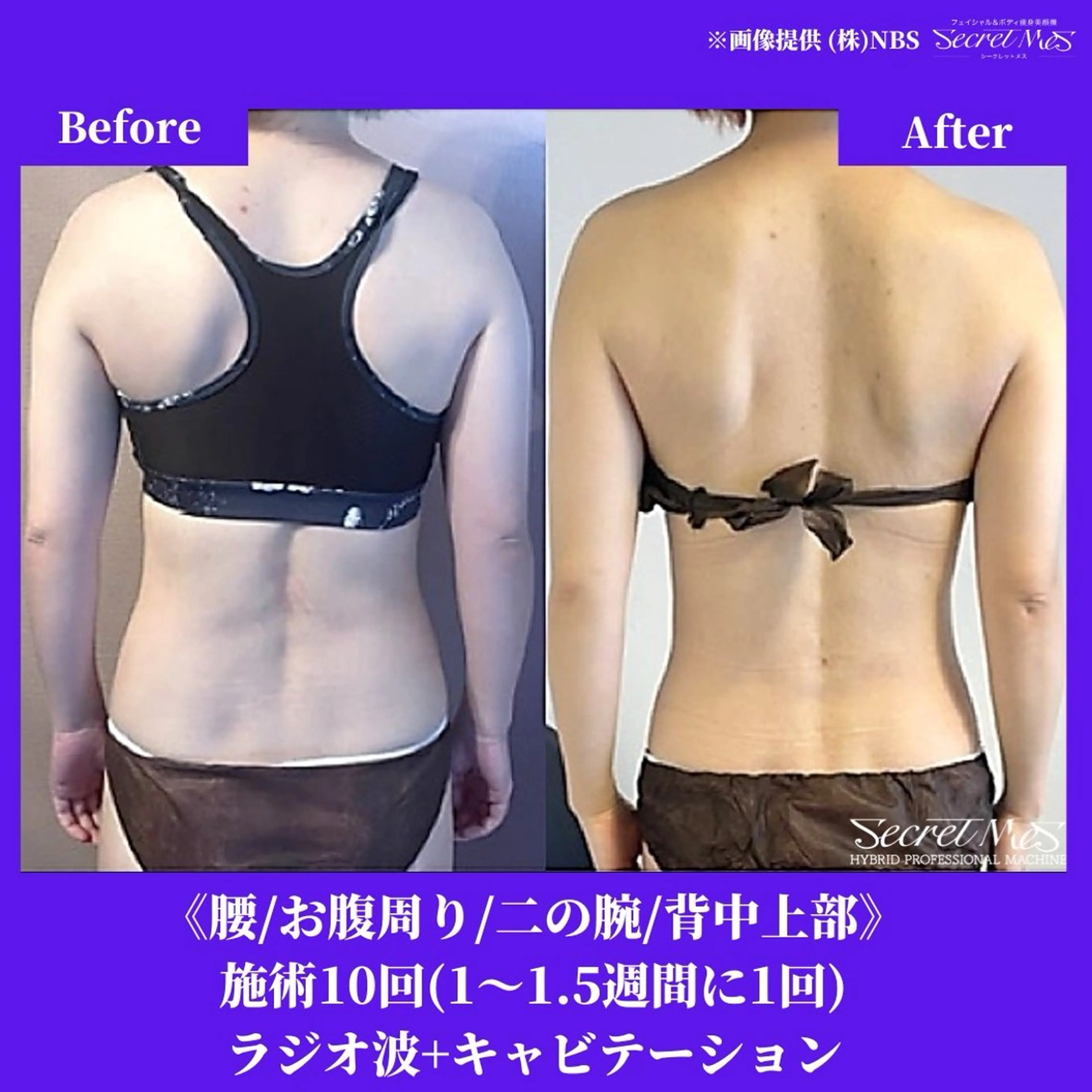 メンズ 有人型セルフサロン 脱毛／痩身／美顔のその他イメージ