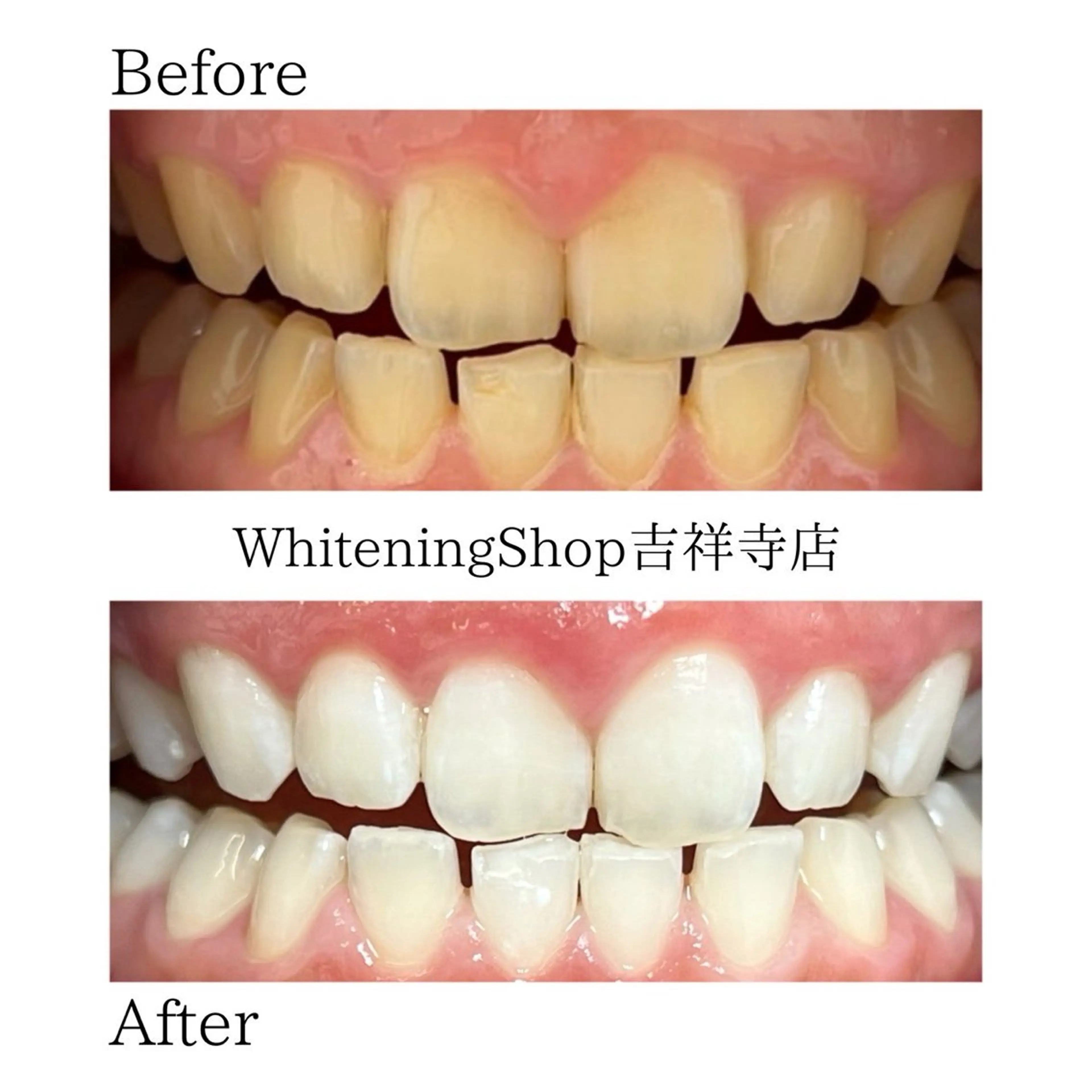 エステ リラク ホワイトニング ショップ吉祥寺店のエステ・リラクイメージ