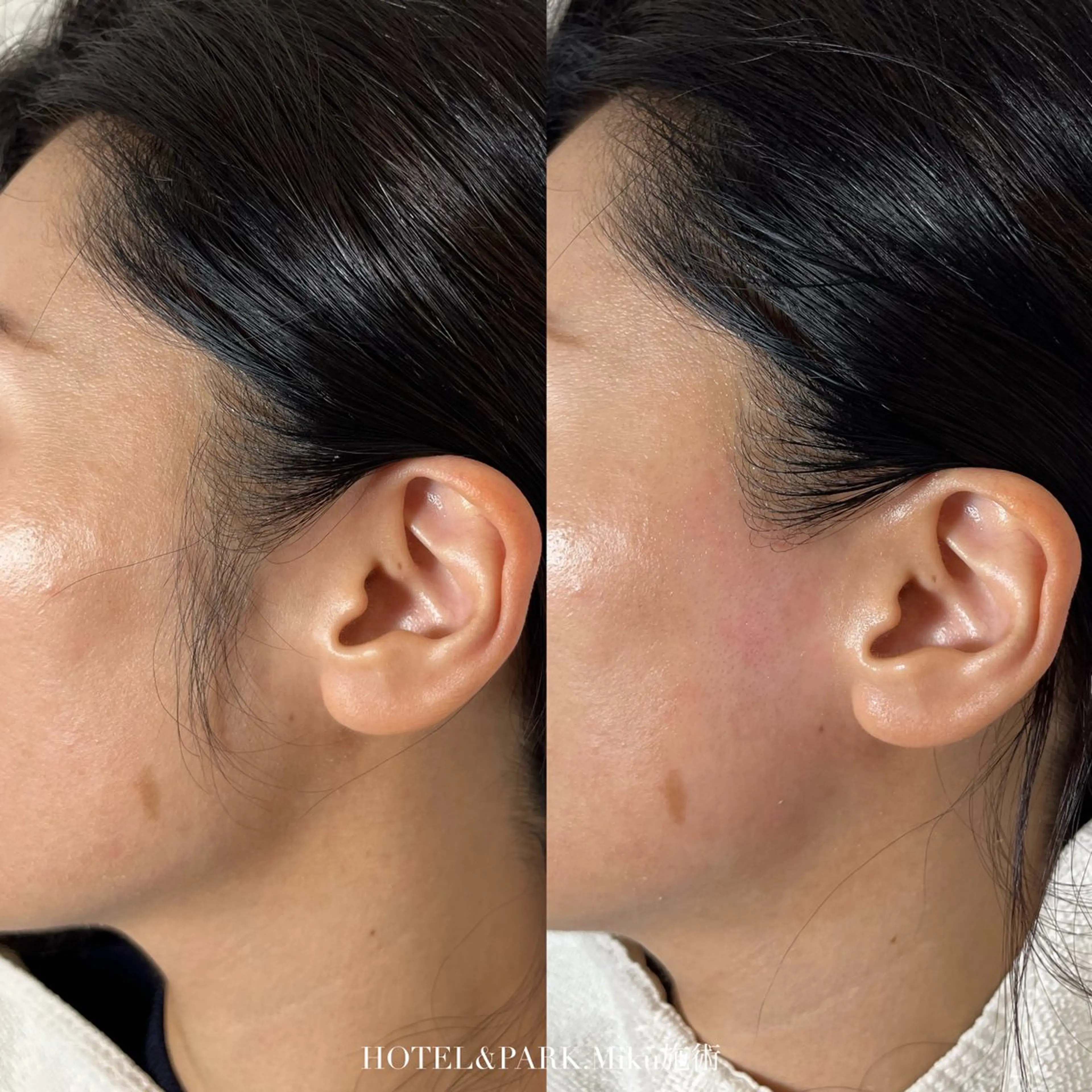 脱毛 HOTEL&PARK Mikuワックス脱毛のエステ・リラクイメージ