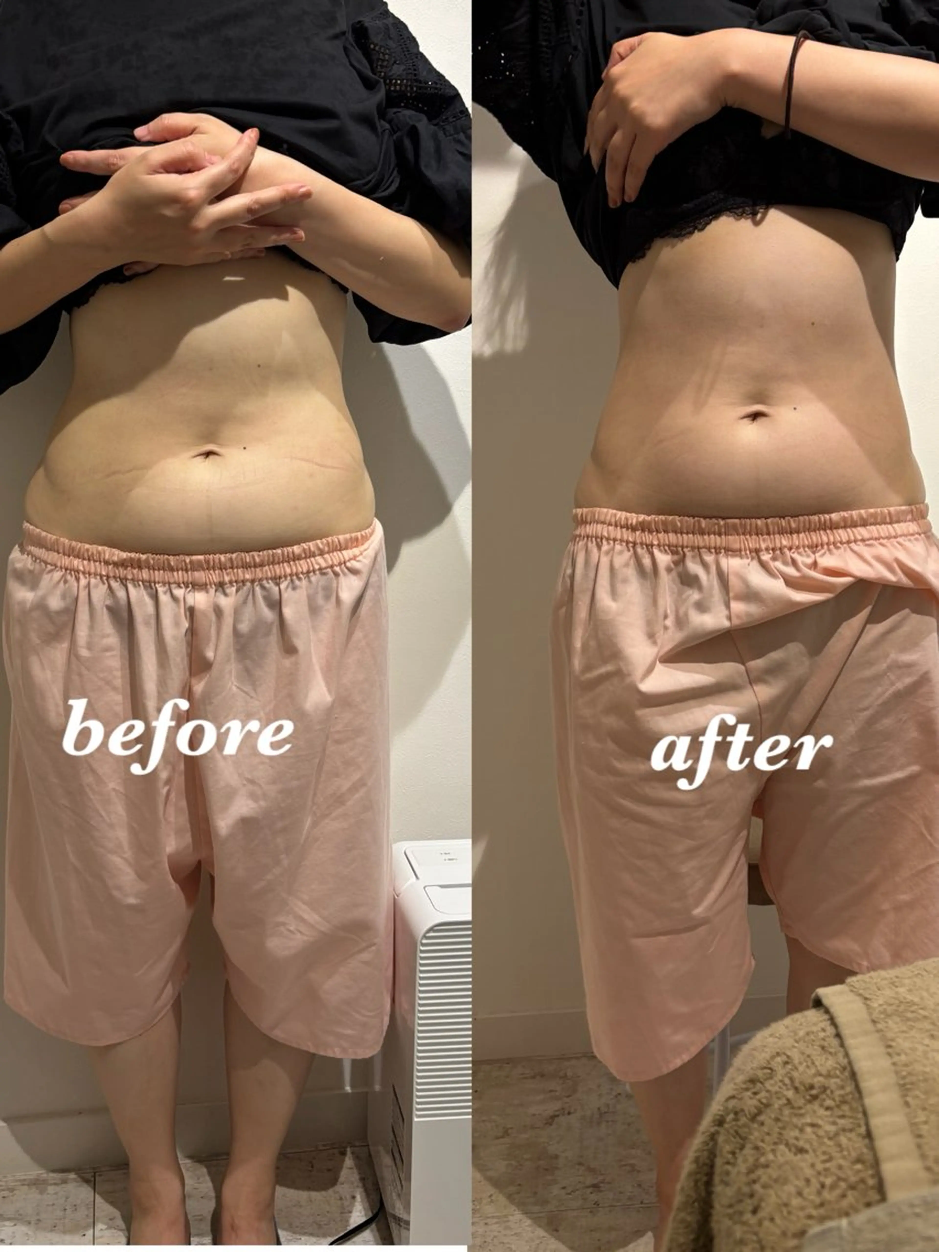 エステ リラク 腸活サポート みなみののエステ・リラクイメージ