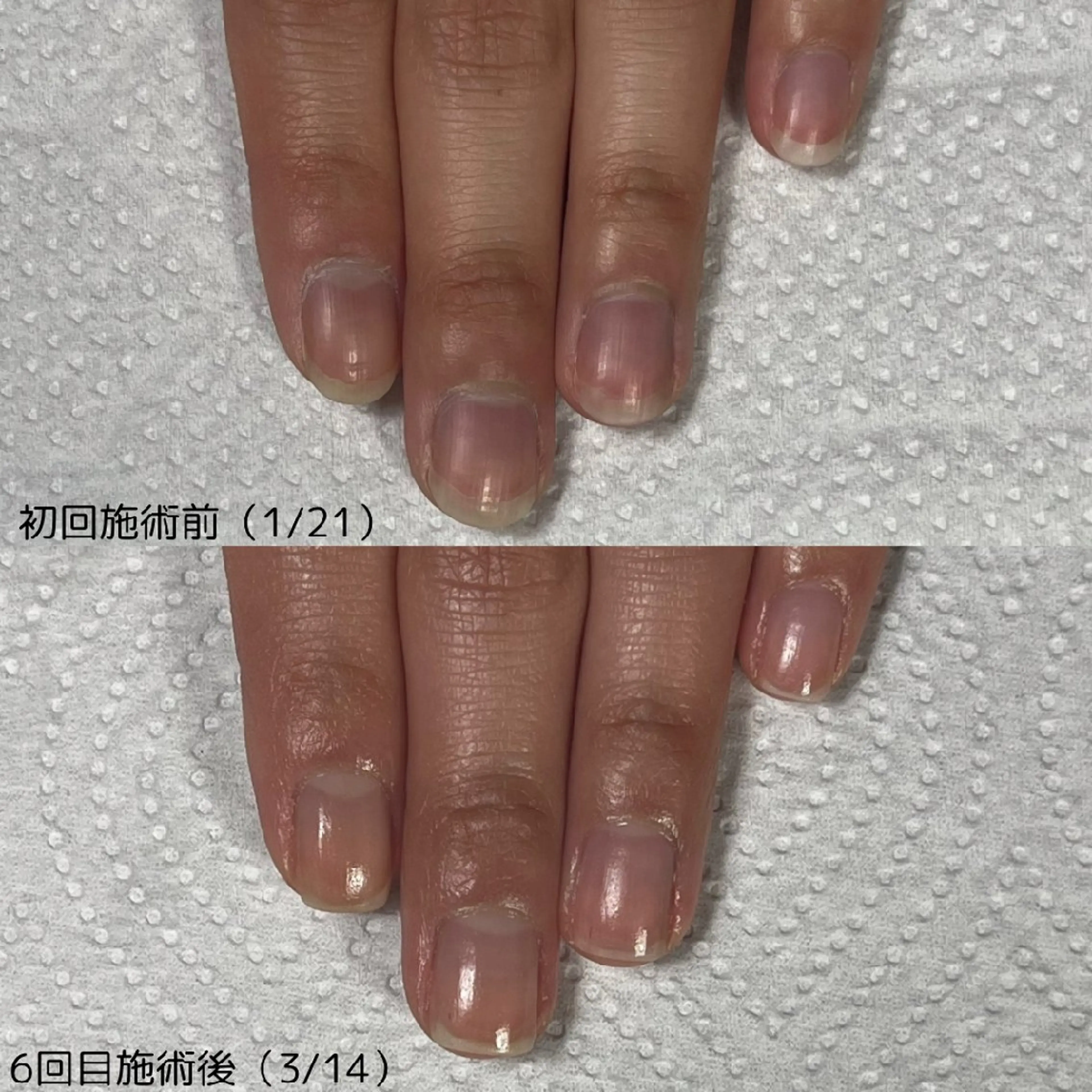 ネイル nail 1623のネイルデザイン