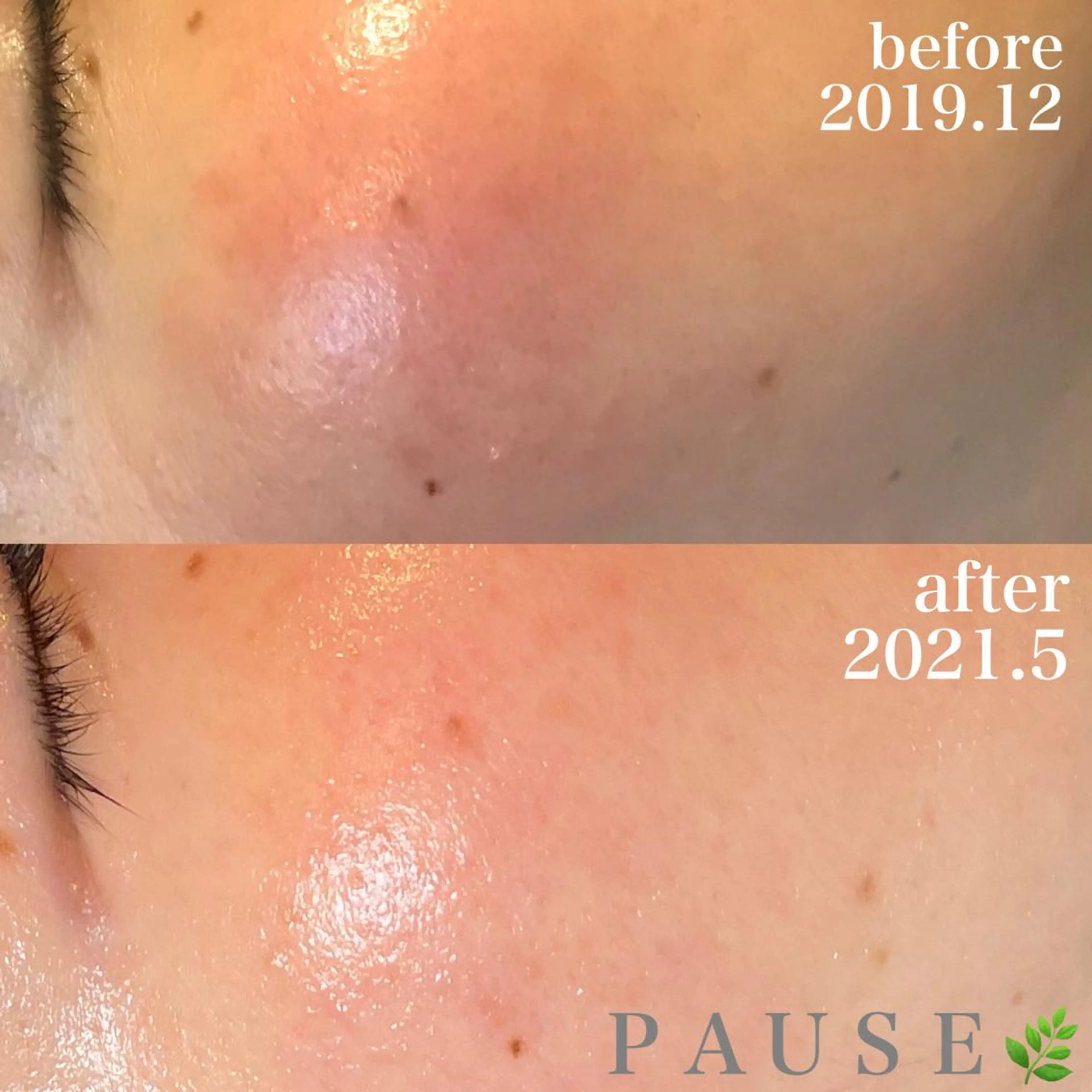 エステ リラク 浜野 恵美のエステ・リラクイメージ