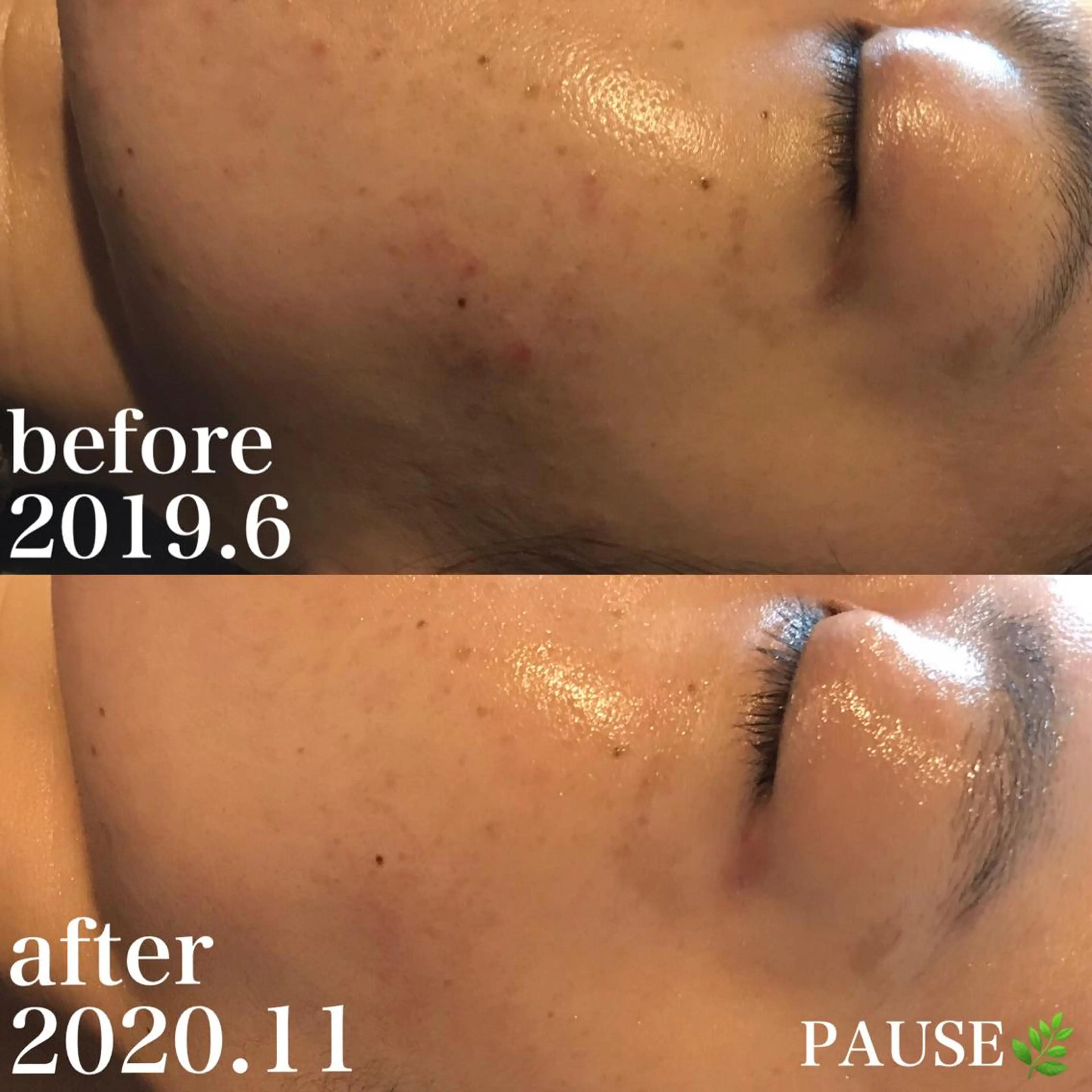 エステ 浜野 恵美のエステ・リラクイメージ