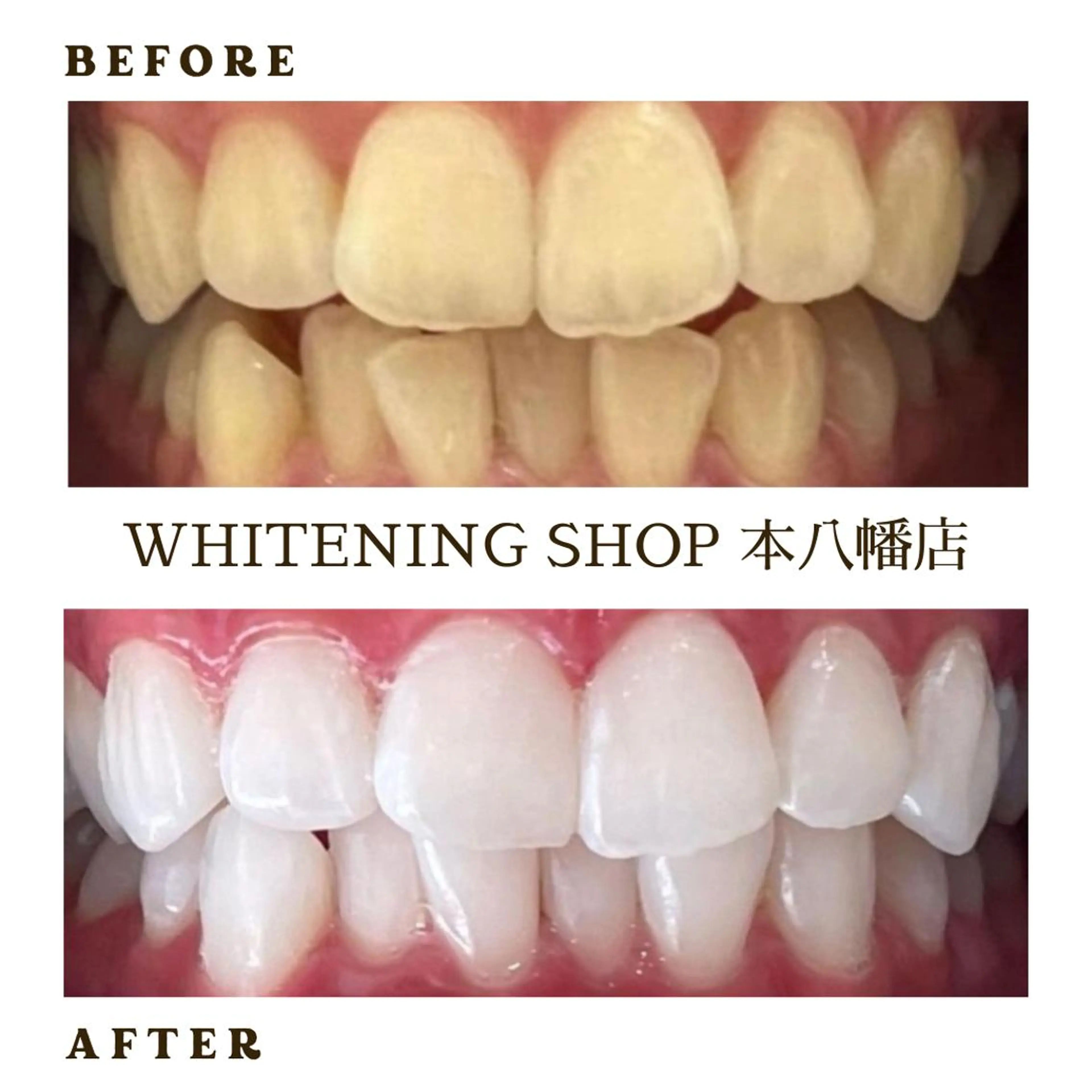 メンズ エステ リラク ホワイトニング ショップ本八幡店のエステ・リラクイメージ