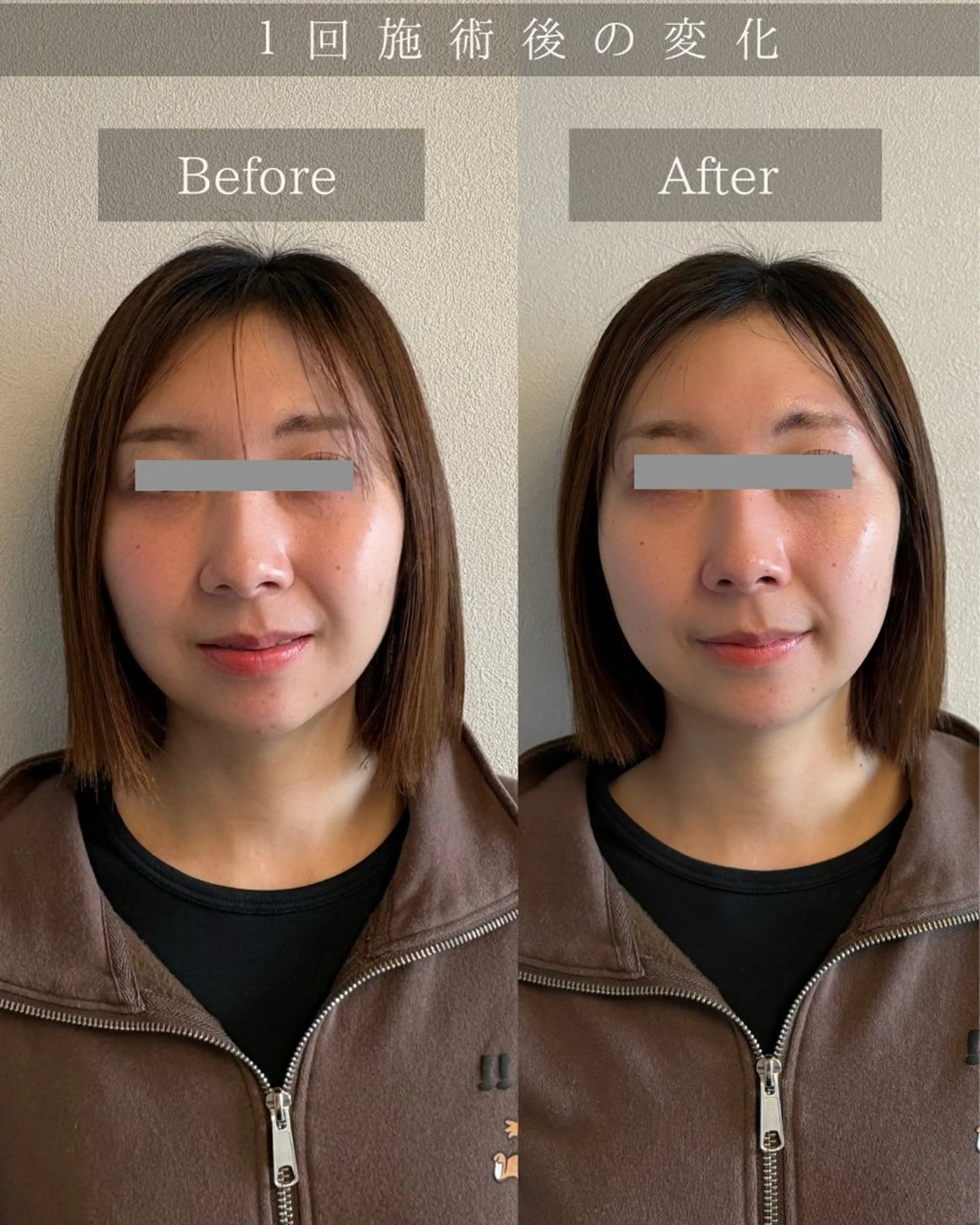 エステ リラク Noelie所属・美肌&小顔矯正 Noelieのエステ・リラクイメージ