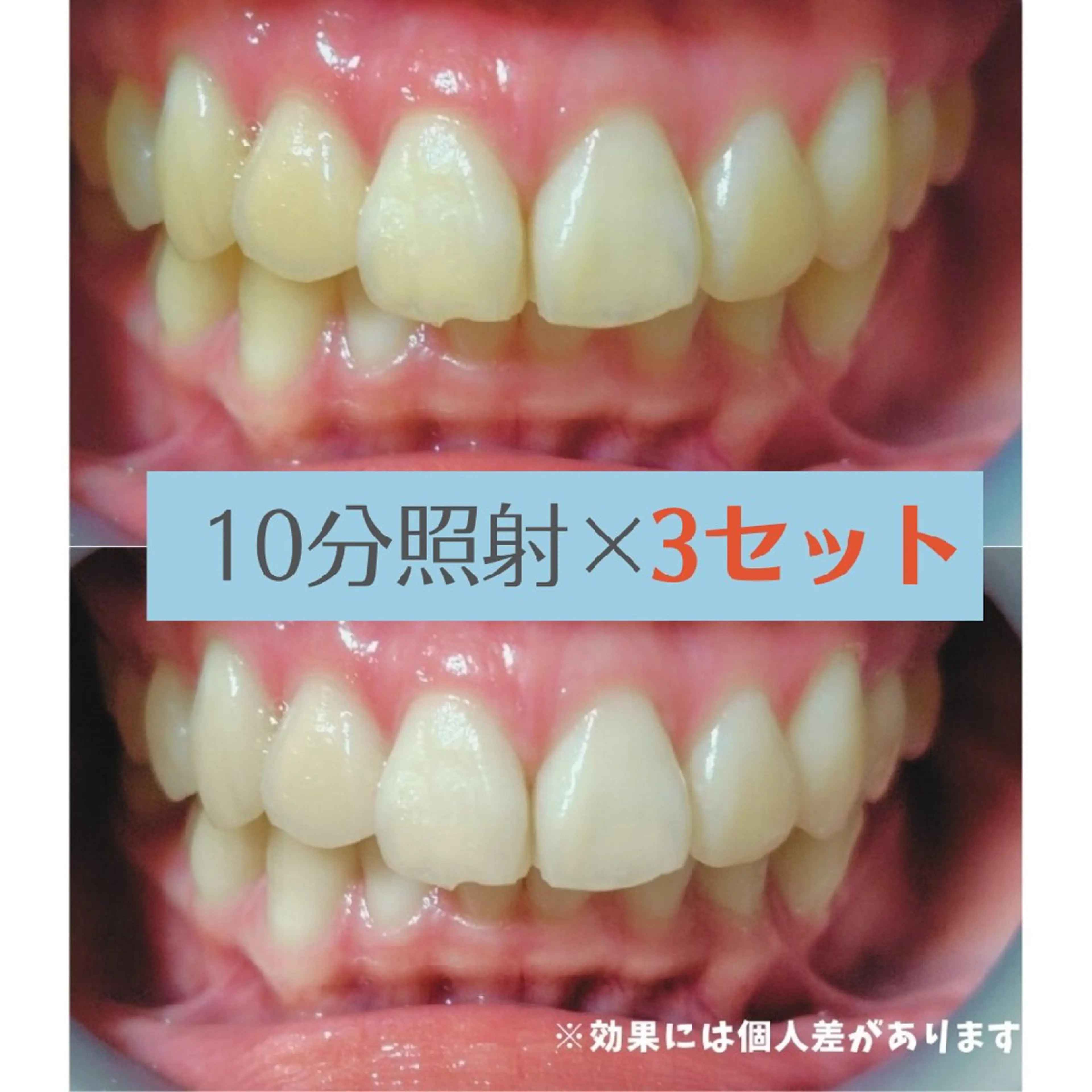 ホワイトニングサロン ネージュ(女性専用)のその他イメージ