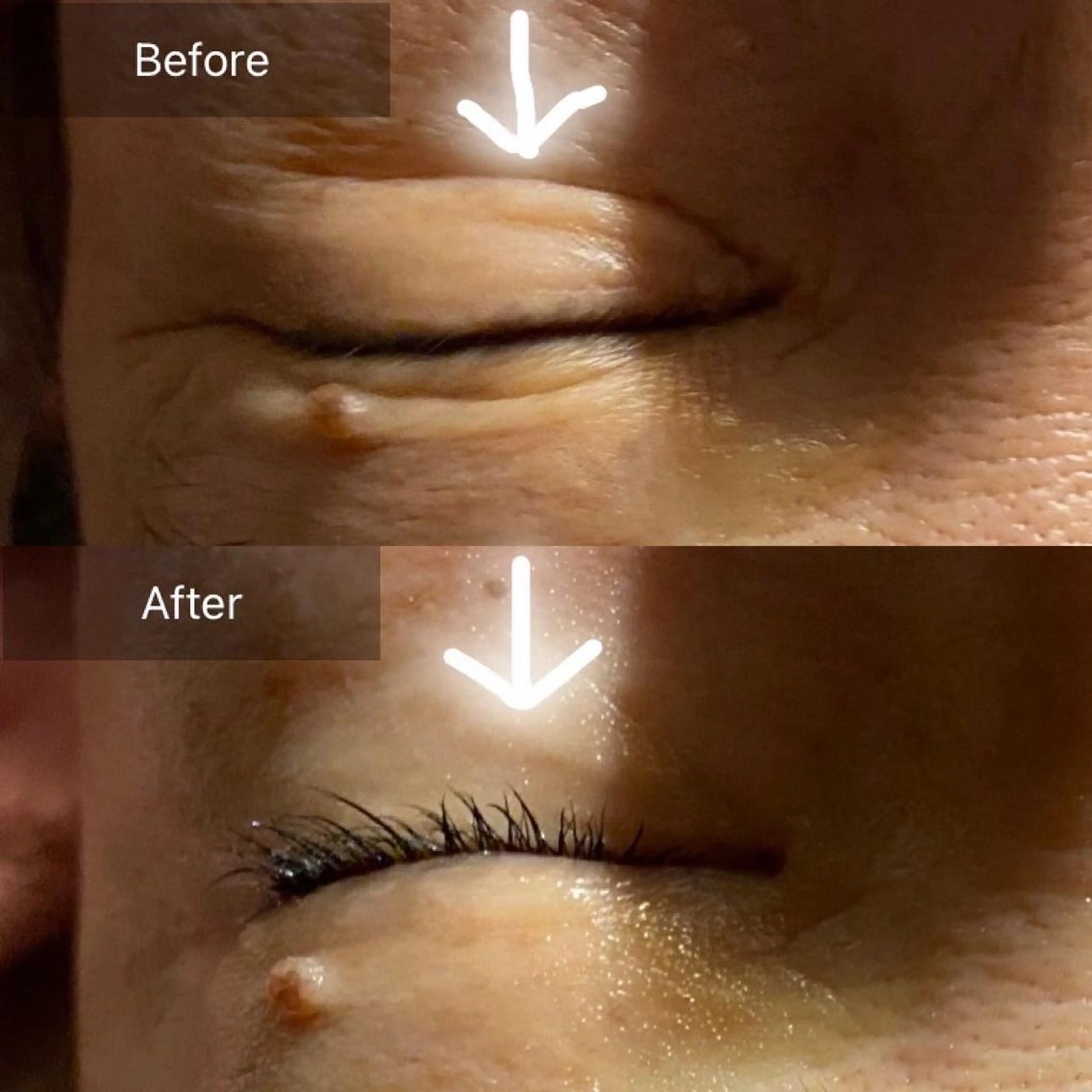 整形級❤️目元マイナス10歳➕瞼スッキリ浮腫ケア♡お顔丸ごとエステ【お茶カウンセリング込120分】の写真