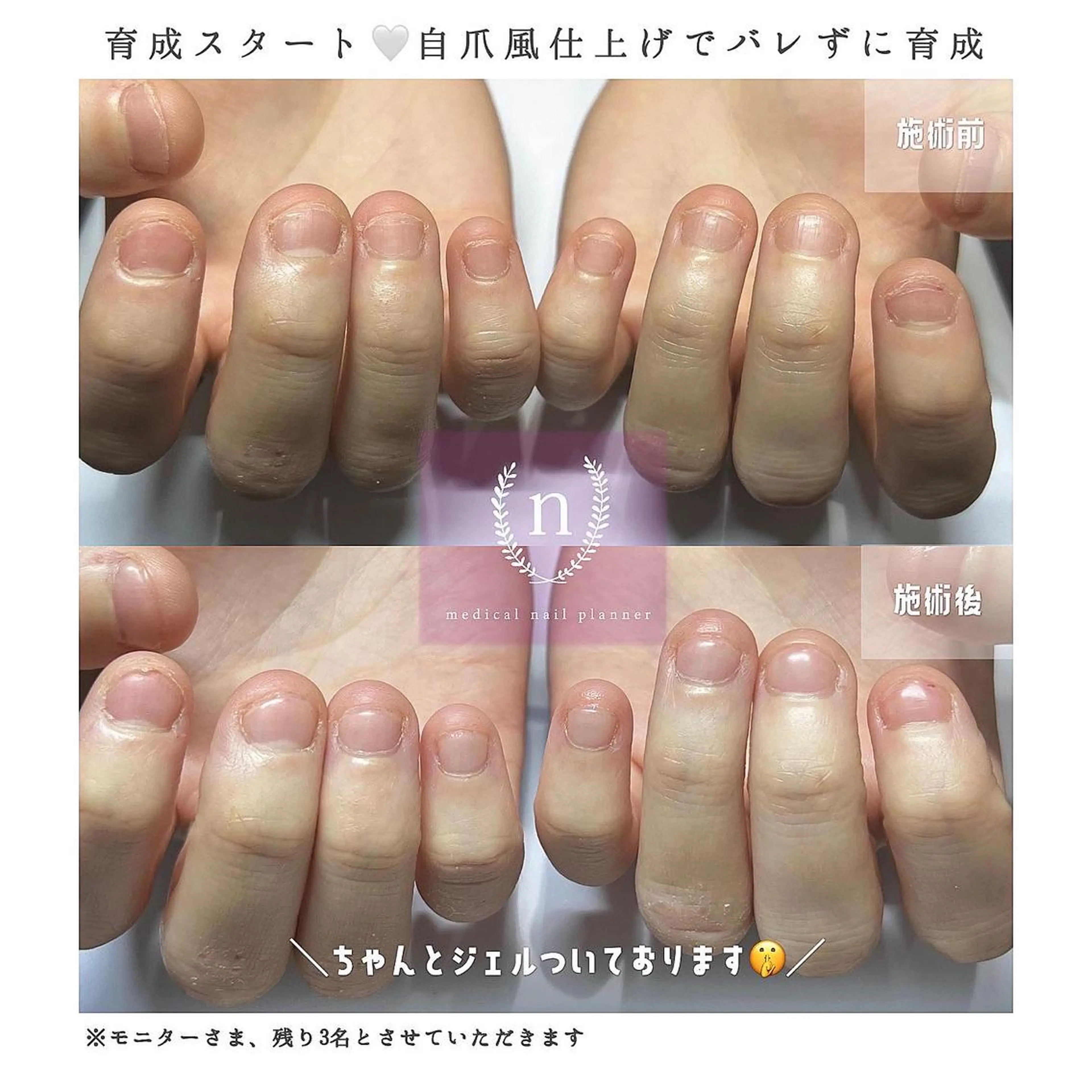 ネイル ハンドネイル ｎａｇｉ所属・自爪育成専門サロン ◌𓈒azumiのネイルデザイン