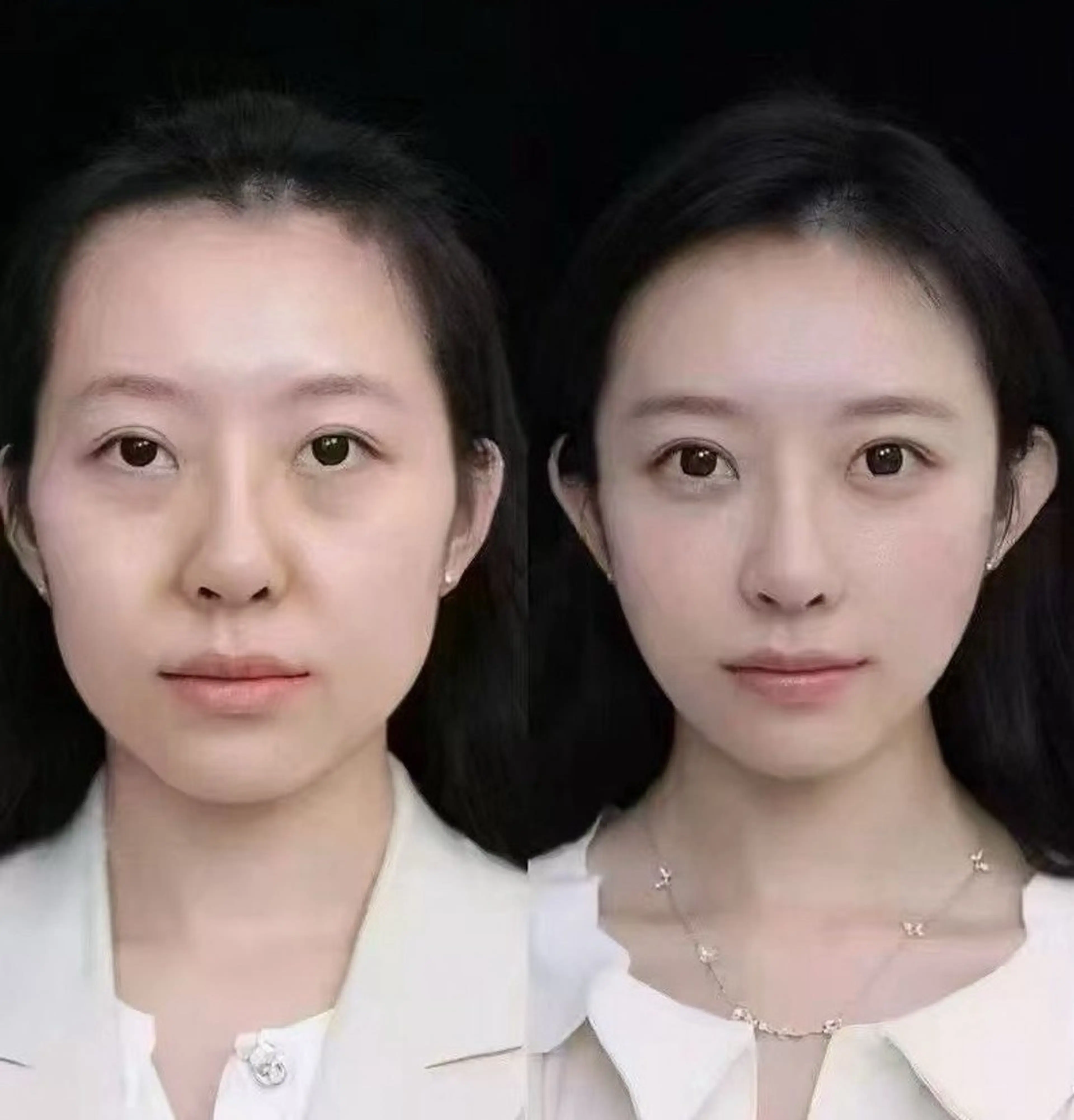 マツエク・マツパ エステ aliaハイフ&水光ジェットサロン所属・aliaハーブ水光店 エステティシャン募集のエステ・リラクイメージ