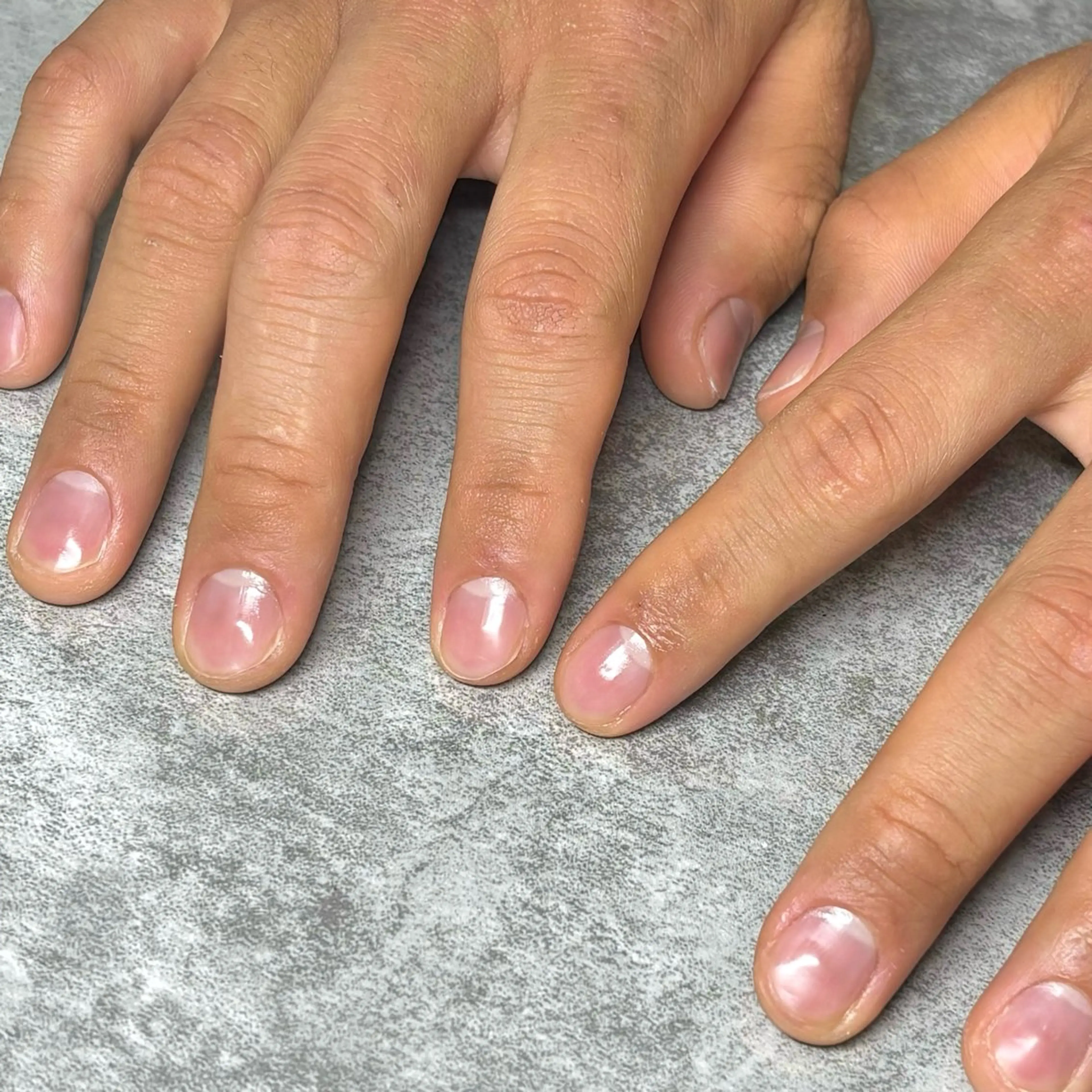 【ハンド】オフケアの写真