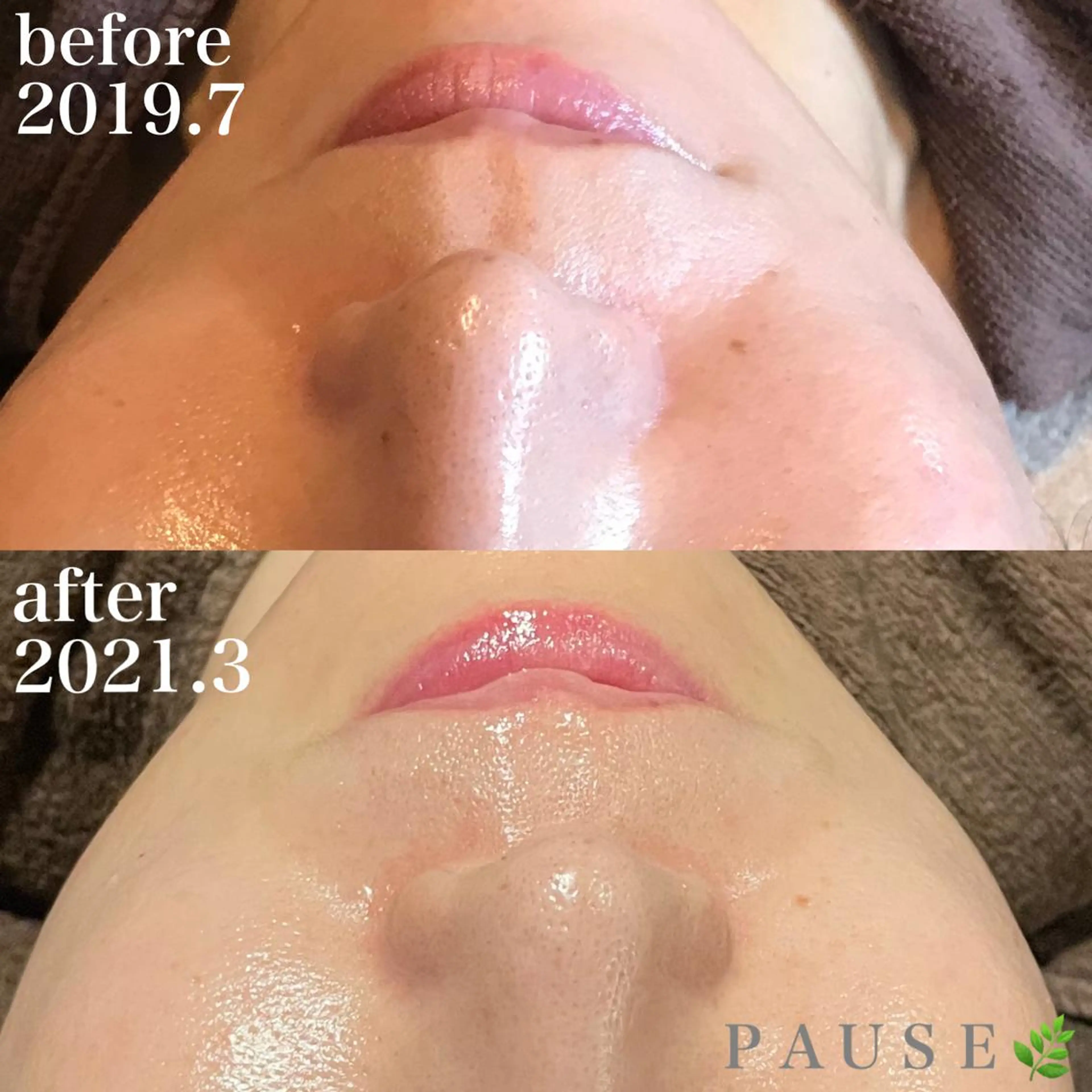 エステ 浜野 恵美のエステ・リラクイメージ