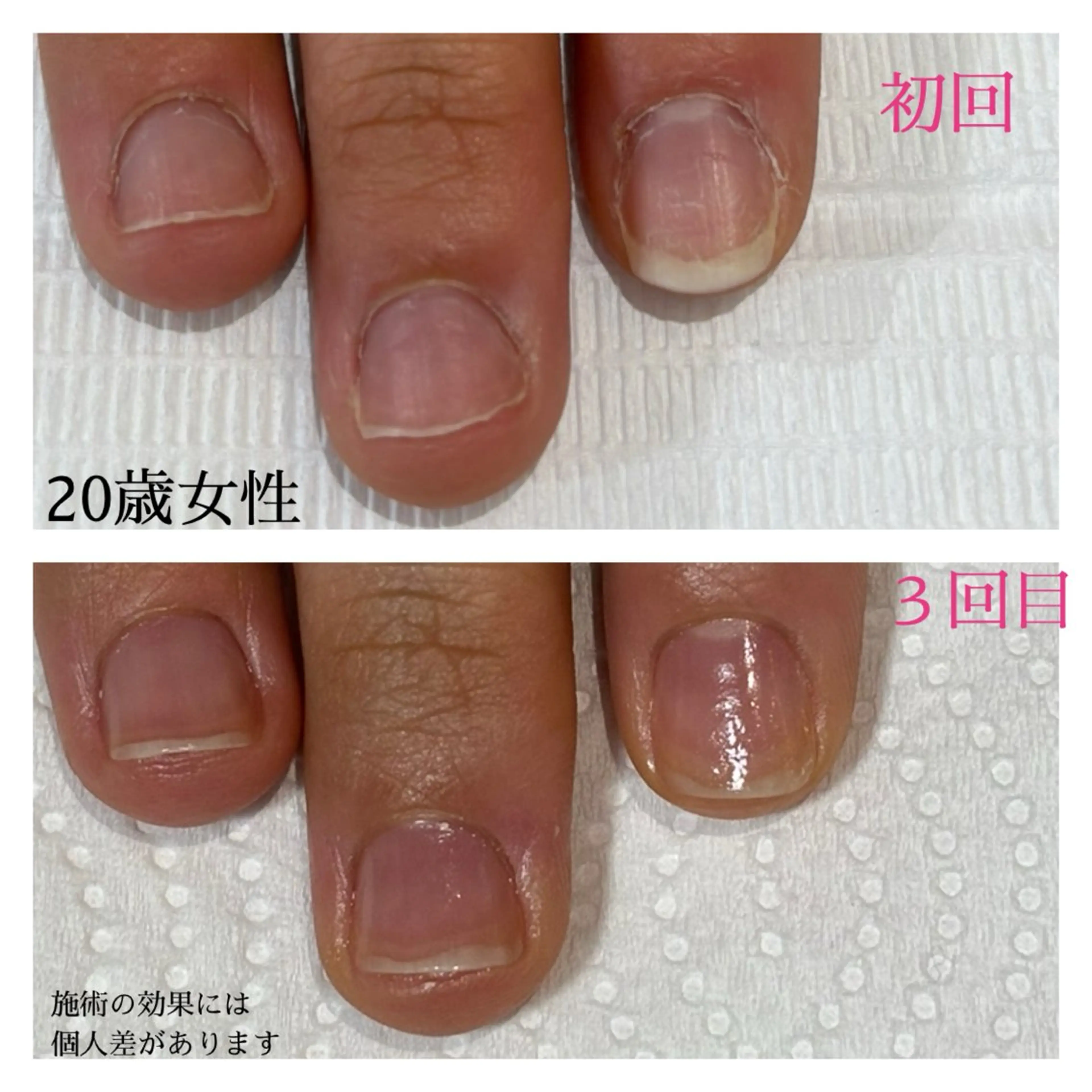 ネイル 自爪育成専門サロン エムロードゥ池下のネイルデザイン