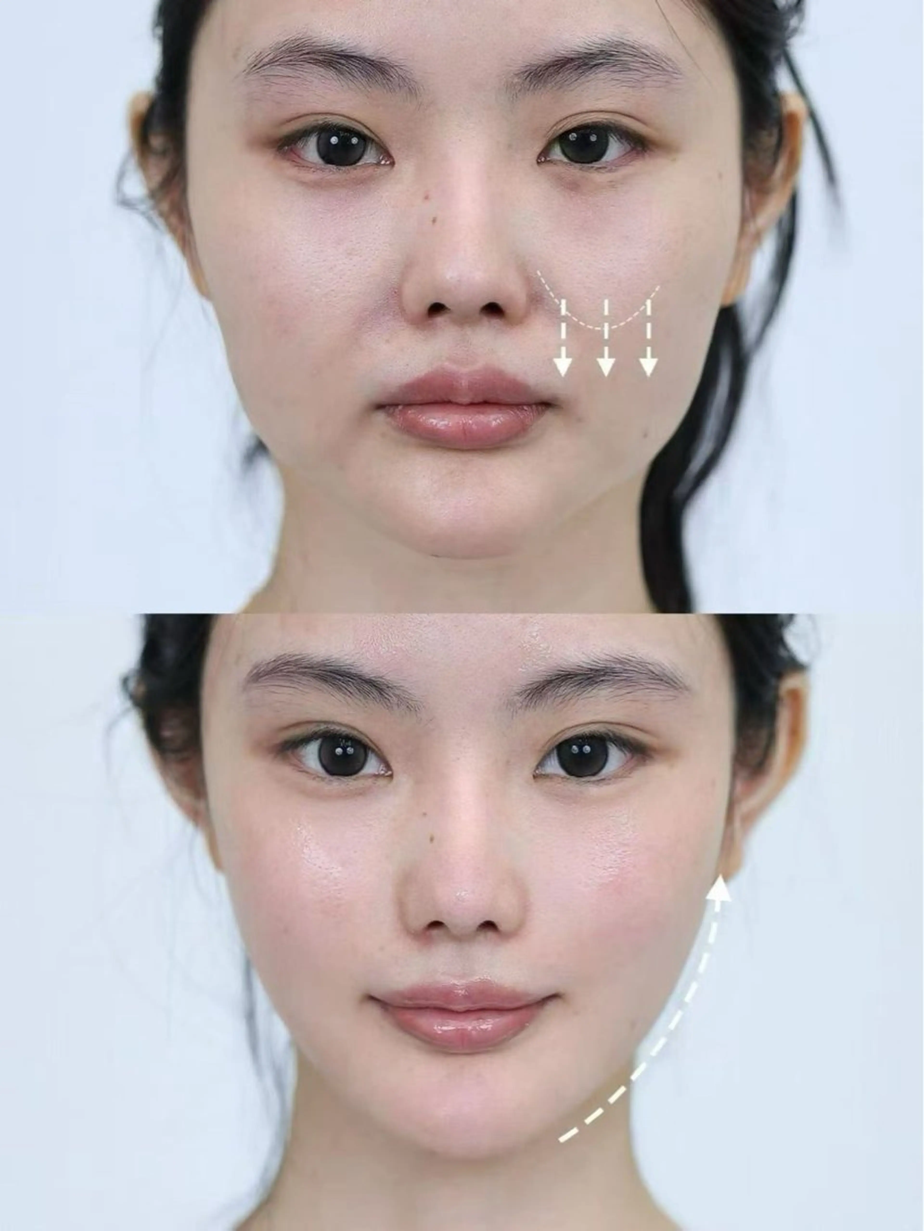 マツエク・マツパ エステ aliaハイフ&水光ジェットサロン所属・aliaハーブ水光店 エステティシャン募集のエステ・リラクイメージ