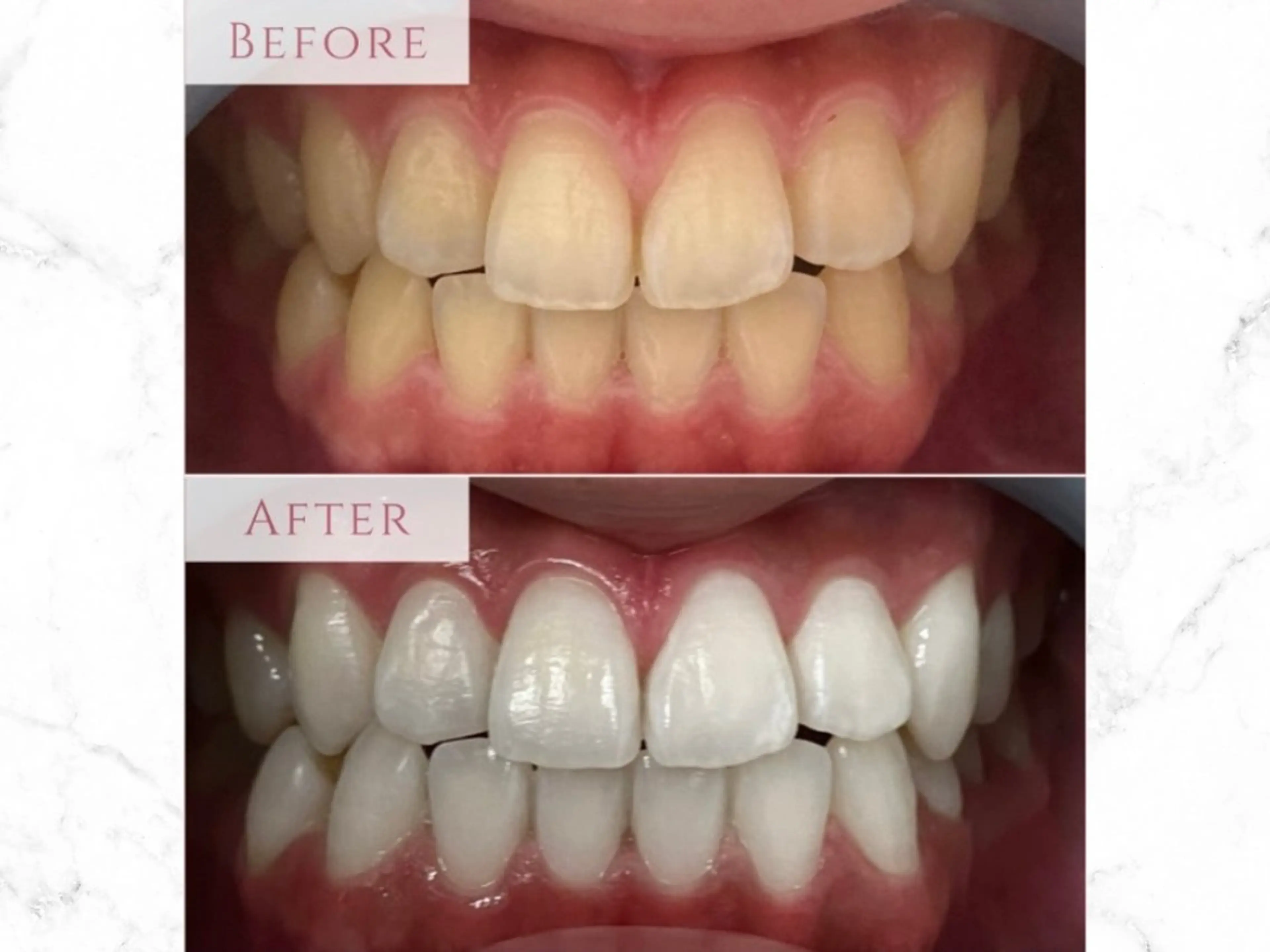 【平日限定🫧】15分×2回　通常4,980¥→2,500円🔥の写真