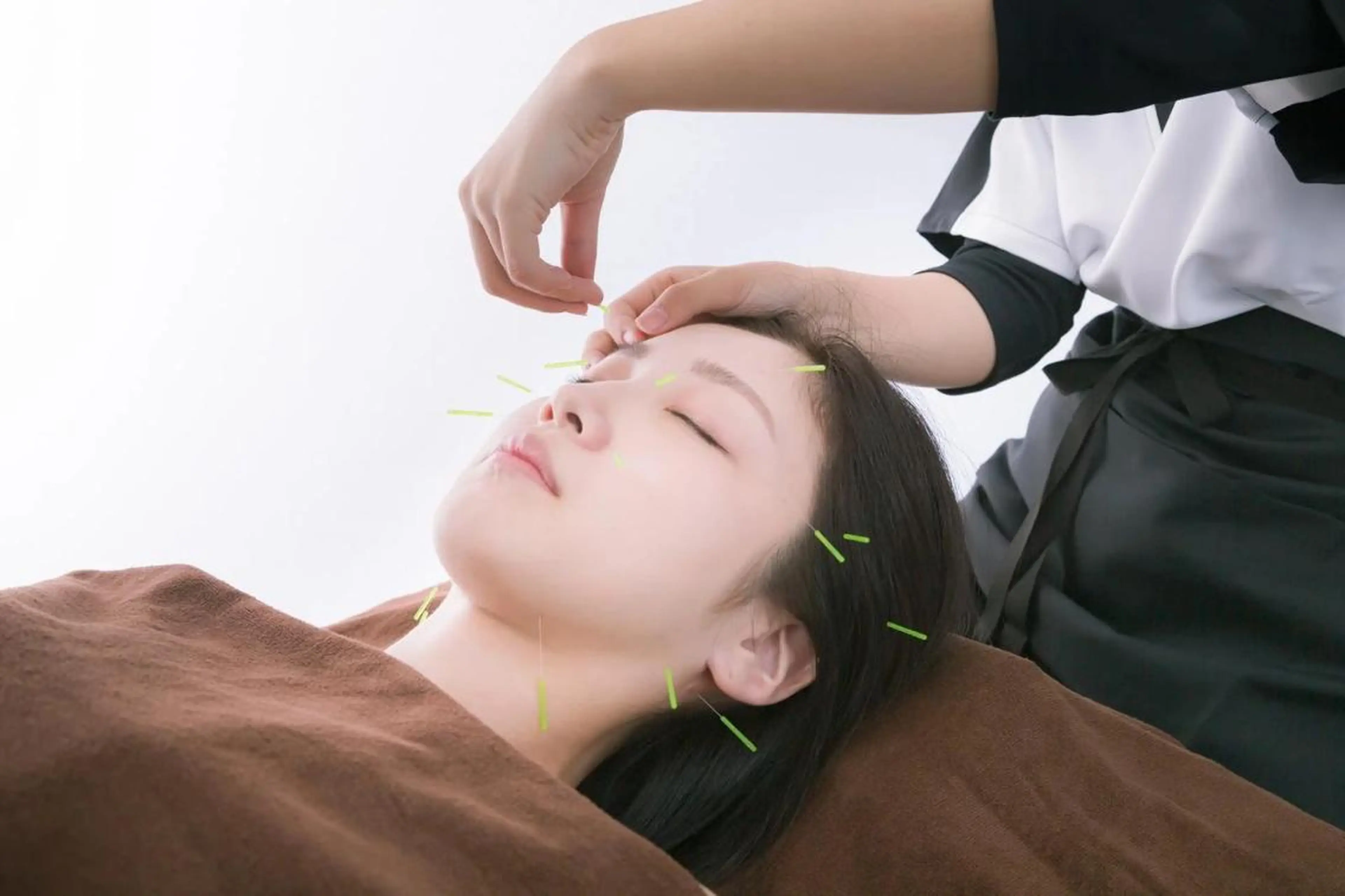 💖新メニュー特別価格💖美容鍼＋首肩ケア✨(お顔+首肩) 　 60分 ¥16,500の写真