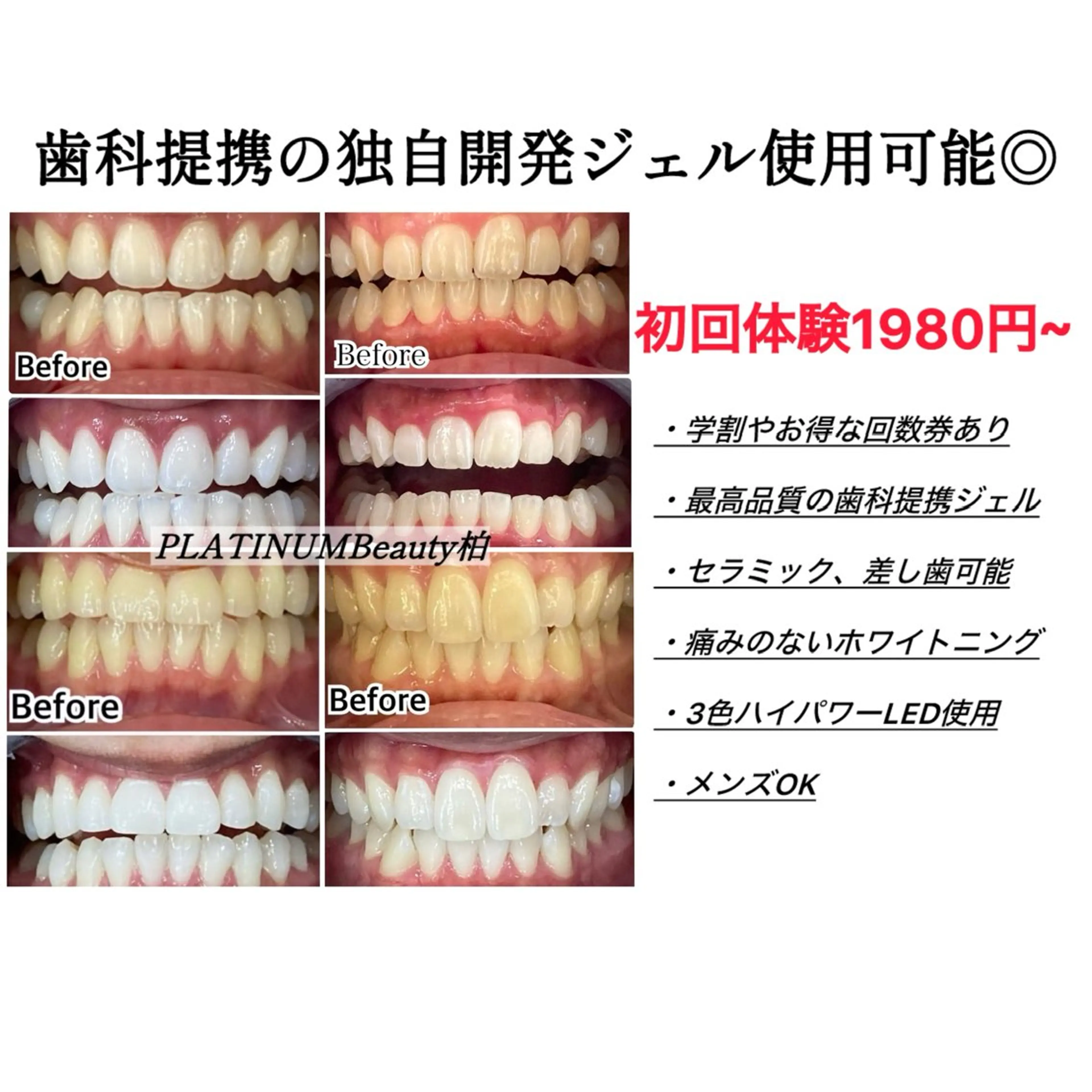 その他 プラチナムビューティー柏所属・【歯科提携】柏ホワイ トニングスタイルのその他イメージ